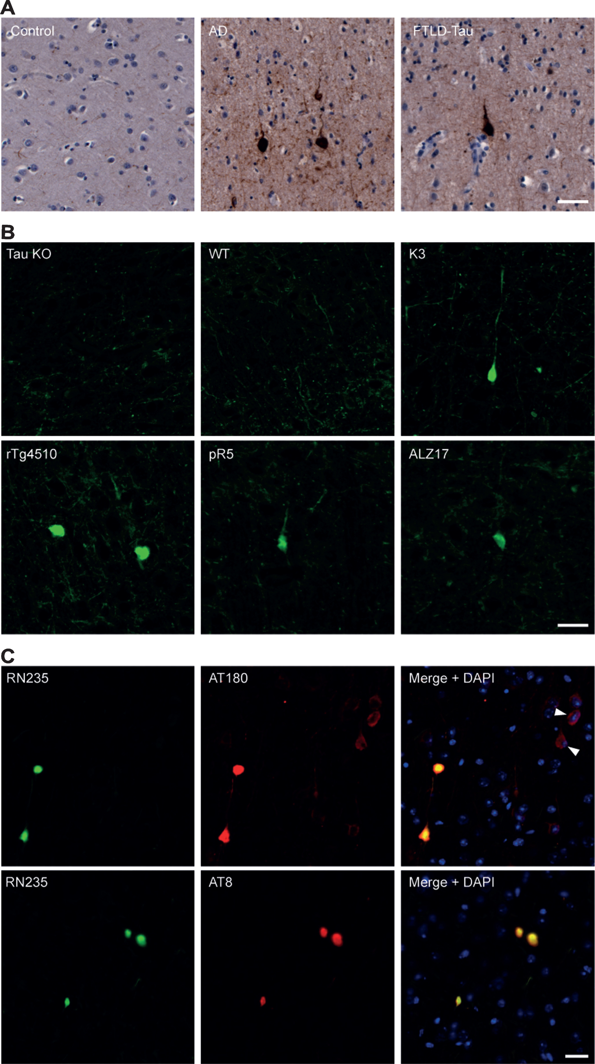 RN235 detects tau NFTs in human and mouse tissue. A) RN235 detects NFTs which lack a definable nucleus in human cortical tissue from patients with Alzheimer’s disease (AD; n = 2; mean age = 84.5 years) and frontotemporal lobar degeneration-tau (FTLD-tau; n = 2; mean age = 88.5 years) but not in control tissue (control; n = 2; mean age = 73 years). B) Similar aggregates are also detected in the cortical tissue of rTg4510 (4 months), ALZ17 (12 months), and pR5 (6 months) tau transgenic mice but not in tau knockout mice (tau KO; 6 months) or wild-type (WT) animals (n = 3). C) Comparison of RN235 (green) labeling to that of the p-Thr231 antibody, AT180, and the p-Ser202/205 antibody, AT8 (both red), in cortical tissue of a 3-month-old K3 mouse, revealing that RN235 labeling is consistent with that of AT8 and detects NFTs without a definable nucleus, whereas AT180 labeling is frequently more diffuse (arrowhead) and the nucleus is clearly observed, consistent with pre-NFTs. Nuclear staining is shown with DAPI (blue). Scale bars = 25μm.