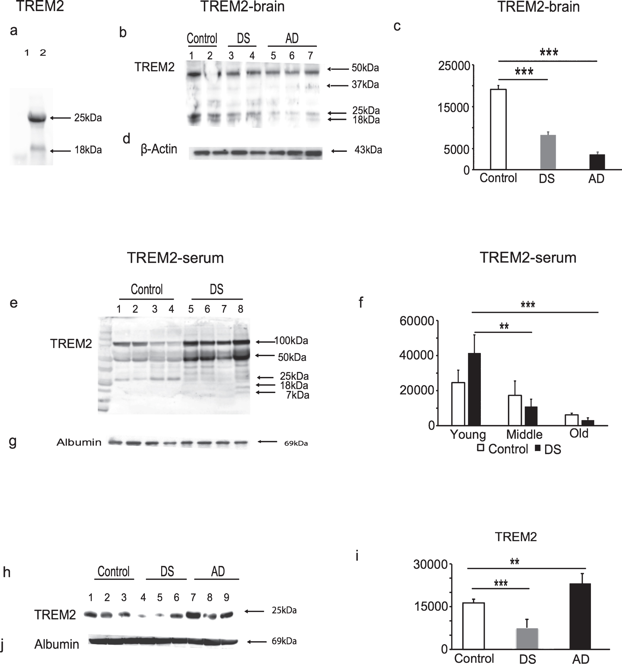 TREM2 protein levels declined with Alzheimer’s diseases progression in Down syndrome. To validate the TREM2 antibody (ab201621), the HEK293 cell line was transfected to overexpress human TREM2, cell lysates were analyzed by WB. The antibody recognized a band of 25 kDa and ∼18 kDa in the TREM2 overexpressing HEK293 cell lysate, whereas in control HEK293 cell lysate no band was seen (a). The WB analyses performed on postmortem human brain tissue (superior frontal cortex) showed that TREM2 levels were highest in controls, significantly decreased in DS and lowest in AD brains (b & c, p < 0.0005). TREM2 serum levels were significantly increased in young DS, lower in middle age, and lowest in the older subjects (e & f, p < 0.001 between older versus younger DS). Similarly, serum TREM2 levels were lower in AD (n = 25), compared with age-matched controls (n = 25) and lowest in DS (h & i, p < 0.001). β-actin and human serum albumin were used as positive controls for brain tissue and serum samples, respectively (d, g, & j). Bonferroni-corrected Student’s t-tests shown; (n = 8–25 per group). Error bars indicate SEM. *p < 0.05, **p < 0.01, ***p < 0.001, one-way ANOVA.