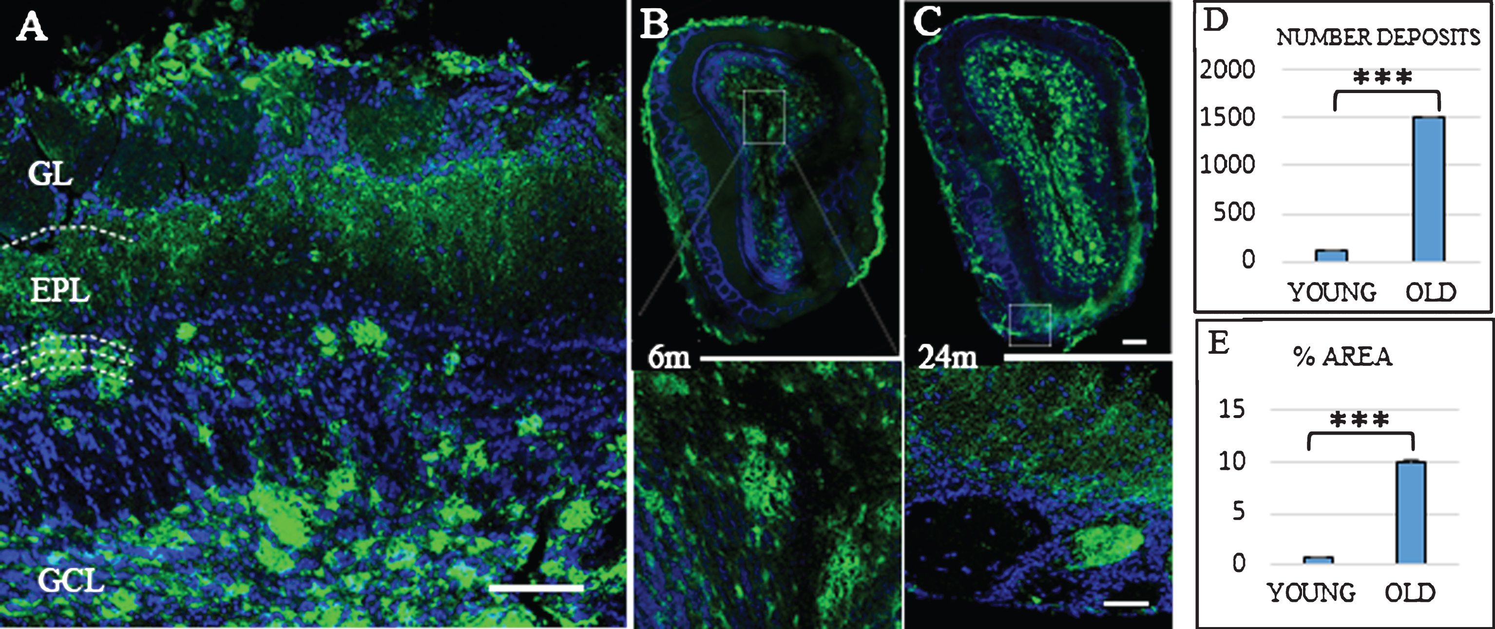 Distribution Aβ-deposits in APPswe/PS1dE9 mice in olfactory bulb (OB) at different ages. A) Localization of Aβ-deposits throughout the different layers (GL, glomerular layer; EPL, external plexiform layer; GCL, granular Cell layer) of the OB in an old mouse. OB in 6-month-old (B) and 24-month-old mice (C). Anti-Aβ in green, and DAPI nuclear staining in blue. Bars, 50μm. D) t-test number of Aβ deposits in OB young (111.467±14.934) versus old (1510.733±72.113) ***p < 0.001. E) t-test % area young (0.658±0.151) versus old (10.063±0.555) ***p < 0.001.