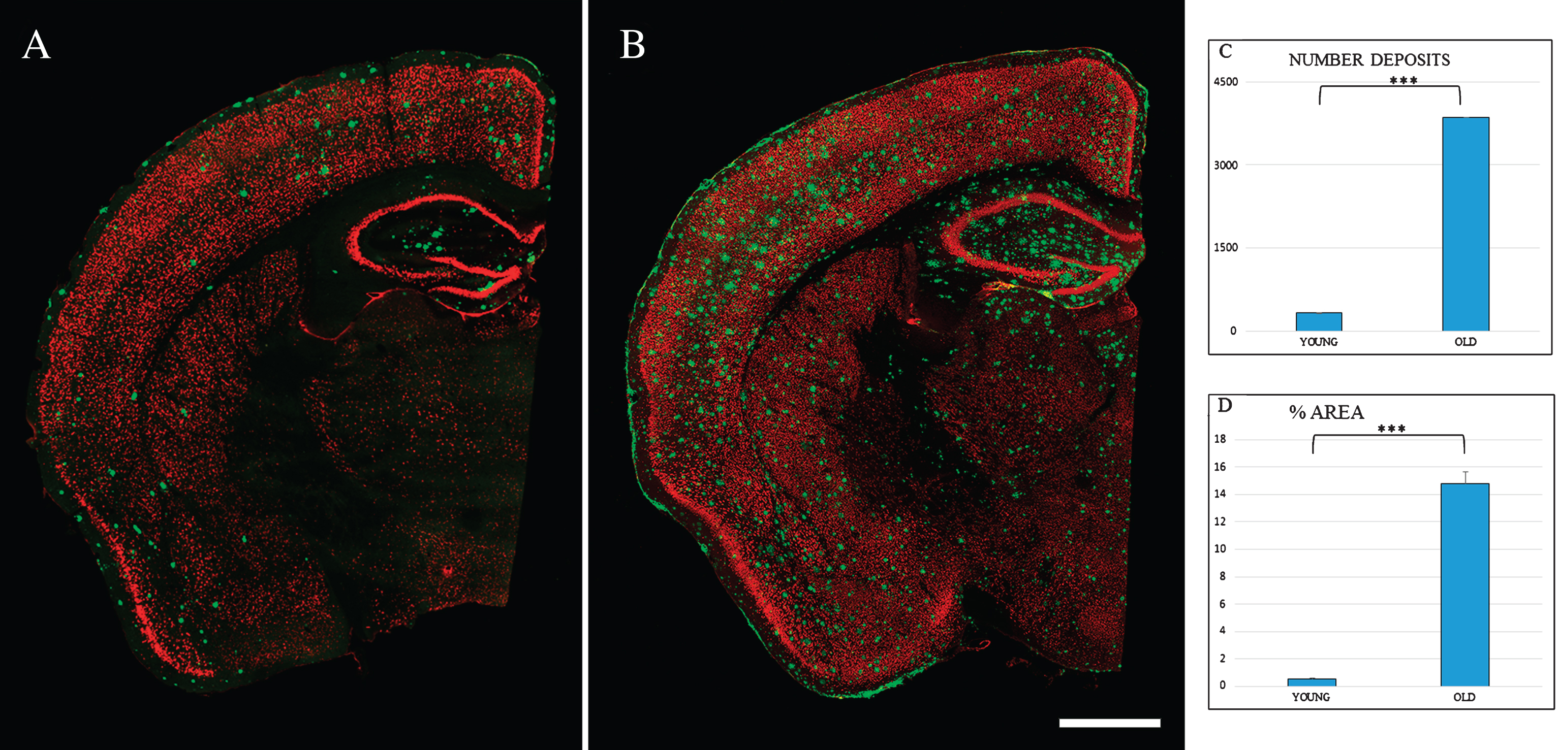 Spatial distribution Aβ-deposits in entorhinal cortex in APPswe/PS1dE9 mice at different ages. Expression of NeuN (red) and antiAβ (green) antibodies. 6-month-old mice (A), 24-month- old mice (B). Coronal section, bars 50μm. C) t-test number of Aβ-deposits in entorhinal cortex in young (324.733±28.747) versus old (3854.867±252.844) ***p < 0.001. D) t-test % area in young (0.539±0.069) versus old (14.801±0.866) ***p < 0.001.