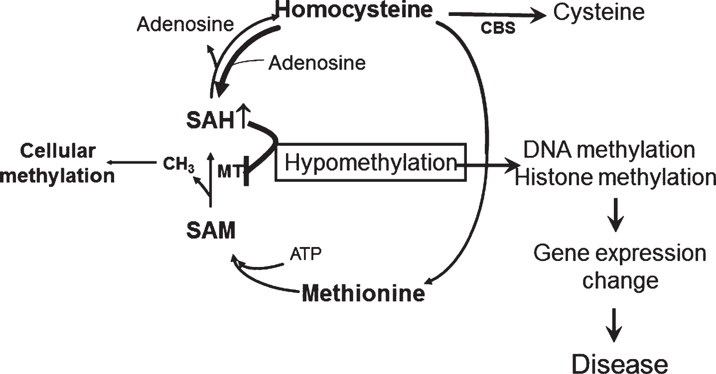 The methylation hypothesis. HHCY promotes SAH increase that blocks DNA and histone methylation by inhibiting DNA methyltranferase (MT). This process results in altered expression of disease associated genes.
