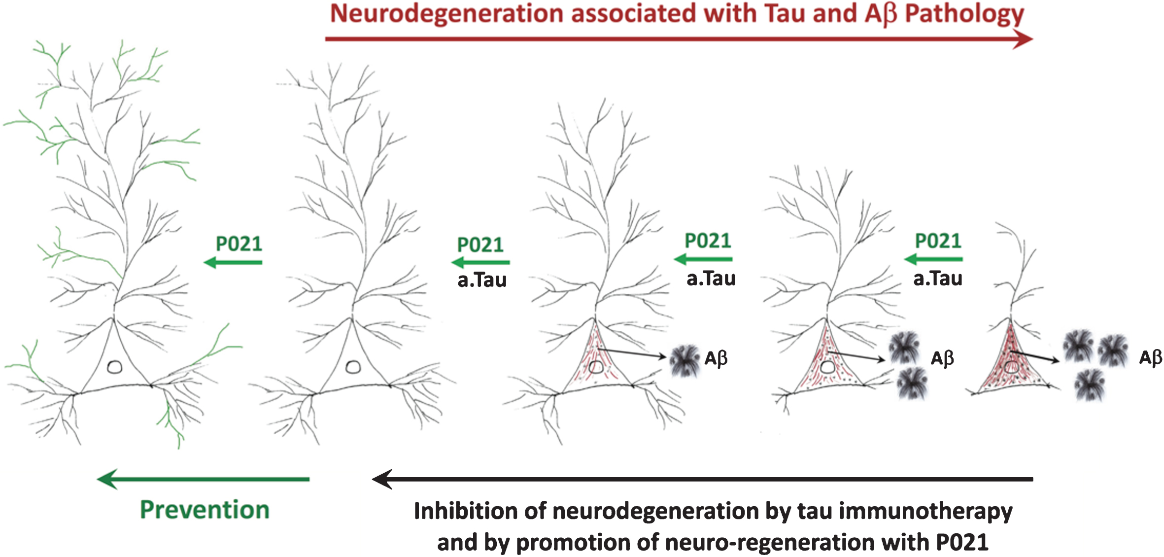 A diagrammatic representation of AD neurofibrillary degeneration and beneficial therapeutic effect of neurotrophic compound P021 and immunization with antibodies to amino-terminal projection domain of tau. Dendrite and synaptic degeneration associated with formation of intraneuronal tau (in red) and Aβ (intraneuronal as black dots and extracellular as plaques) pathologies is a hallmark of AD. Increase in dendritogenesis and synaptogenesis (shown in green) can prevent loss of neuronal connectivity and thereby inhibit tau and Aβ pathologies, especially if the neurotrophic support such as P021is provided before any pathology. Clearance of tau pathology by passive immunization probably rescues neuronal connectivity deficit and consequently prevents Aβ pathology by inhibiting the amyloidogenic processing of AβPP. a.tau, anti tau.