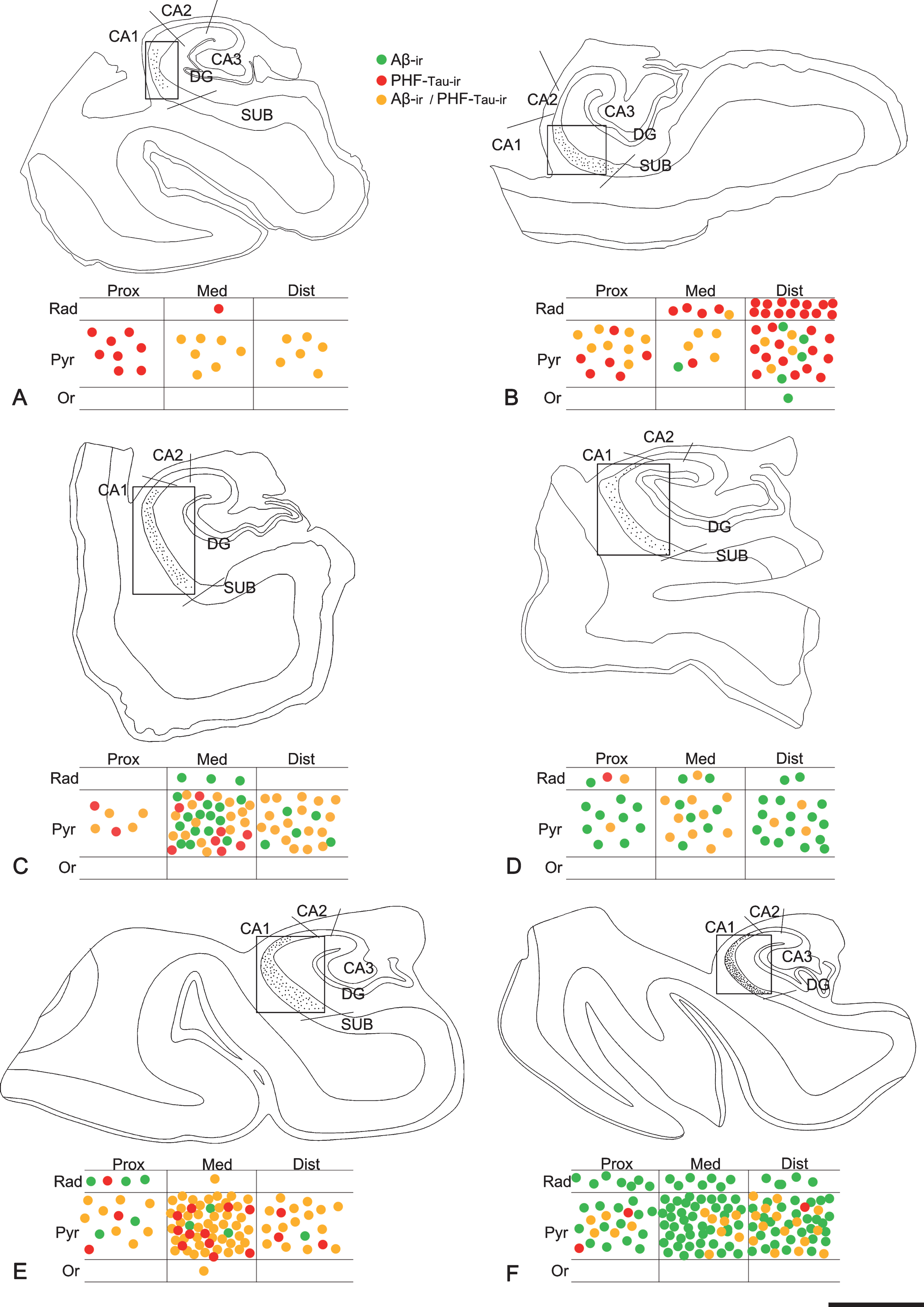 Maps of the hippocampal formation from AD patients to illustrate plaque distribution and staining patterns in CA1. Plots are based on the analysis of double-immunostained sections for anti-Aβ and anti-PHF-Tau antibodies. Borders between hippocampal fields are indicated by lines. CA1 is marked with a rectangle. Below each section profile, CA1 is shown schematically with its corresponding subregions and layers. Green dots correspond to Aβ-ir plaques, red dots to PHF-Tau-ir plaques (either PHFpS396 or PHFAT8), and yellow dots indicate plaques expressing both Aβ and PHF-Tau proteins. A–F) Representative drawings from patients Az1, Az2, Az3, Az4, Az5 and Az6, respectively. DG, dentate gyrus; CA1–CA3, cornu ammonis fields; SUB, subiculum; Prox, proximal; Med, medial; Dist, distal; Or, stratum oriens; Pyr, stratum pyramidale; Rad, stratum radiatum. Scale bar (in F): 2000μm.