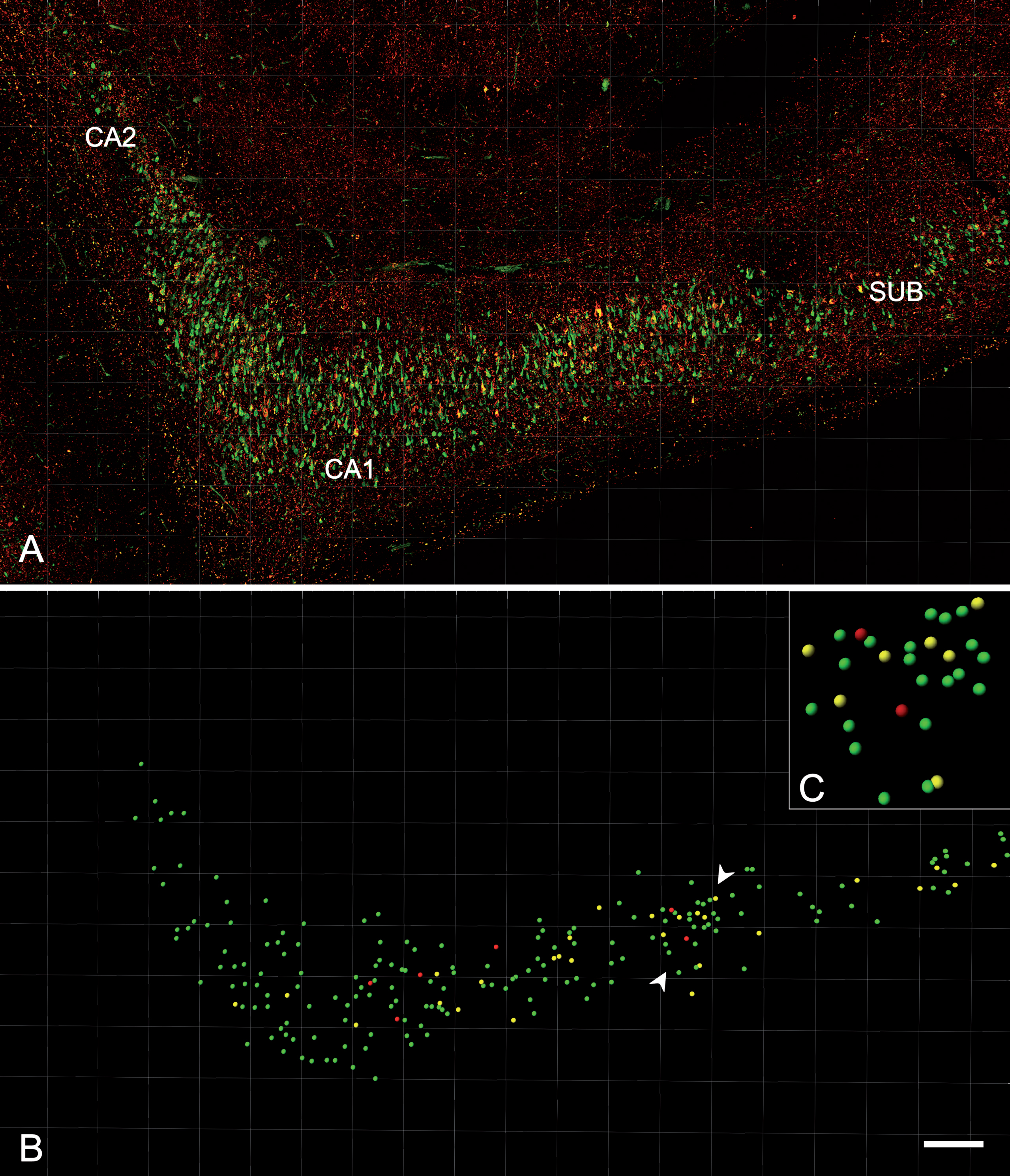 Analysis of the distribution and expression of PHF-Tau-ir neurons using Imaris software. A) Confocal microscopy image showing a double-immunostained section for PHFpS396 (green) and PHFAT8 (red) antibodies, in CA1 region from patient Az4. The entire CA1 region can be visualized. B) Spots are assigned to each neuron, easily visualized when confocal channels are turned off. C) The rectangle is a higher magnification of the region marked by the arrowheads in B. The different spot colors correspond to PHFpS396-ir neurons (green), PHFAT8-ir neurons (red), and coexpressing neurons (yellow). Scale bar: 200μm (in B); 50μm in (C).