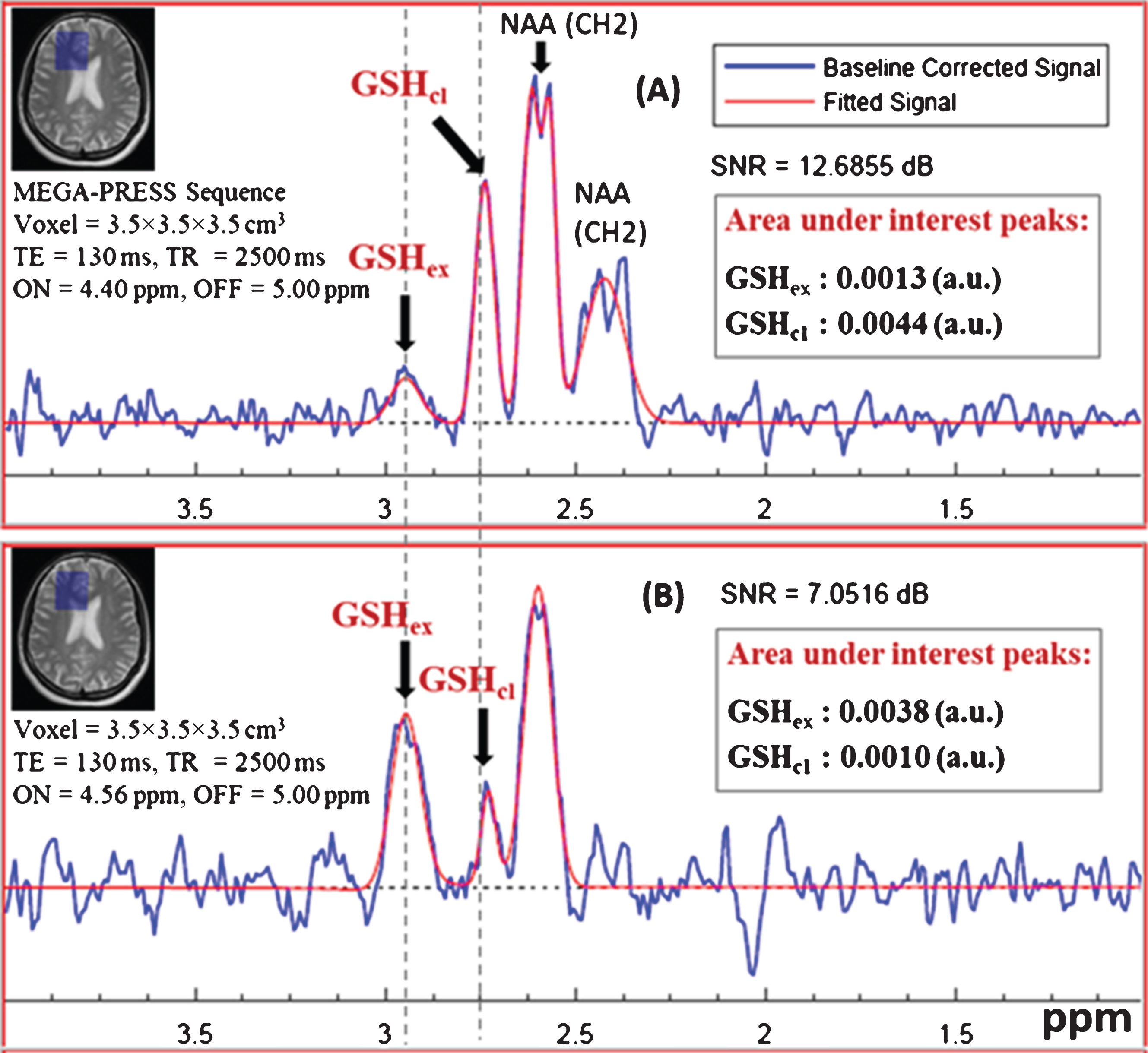 Detection of the two (extended and closed) in vivo GSH conformer peaks (GSHex and GSHcl) in healthy control subject using MEGA-PRESS experiment. Data was collected using 3T Philips scanner at NBRC. Data acquisition was performed with following parameters: TE = 130 ms, TR = 2500 ms, (A) MEGA-ON/OFF = 4.40 ppm/5.00 ppm and, (B) MEGA-ON/OFF = 4.56 ppm/5.00 ppm) (voxel size = 3.5×3.5×3.5 cm3 on right frontal cortex).