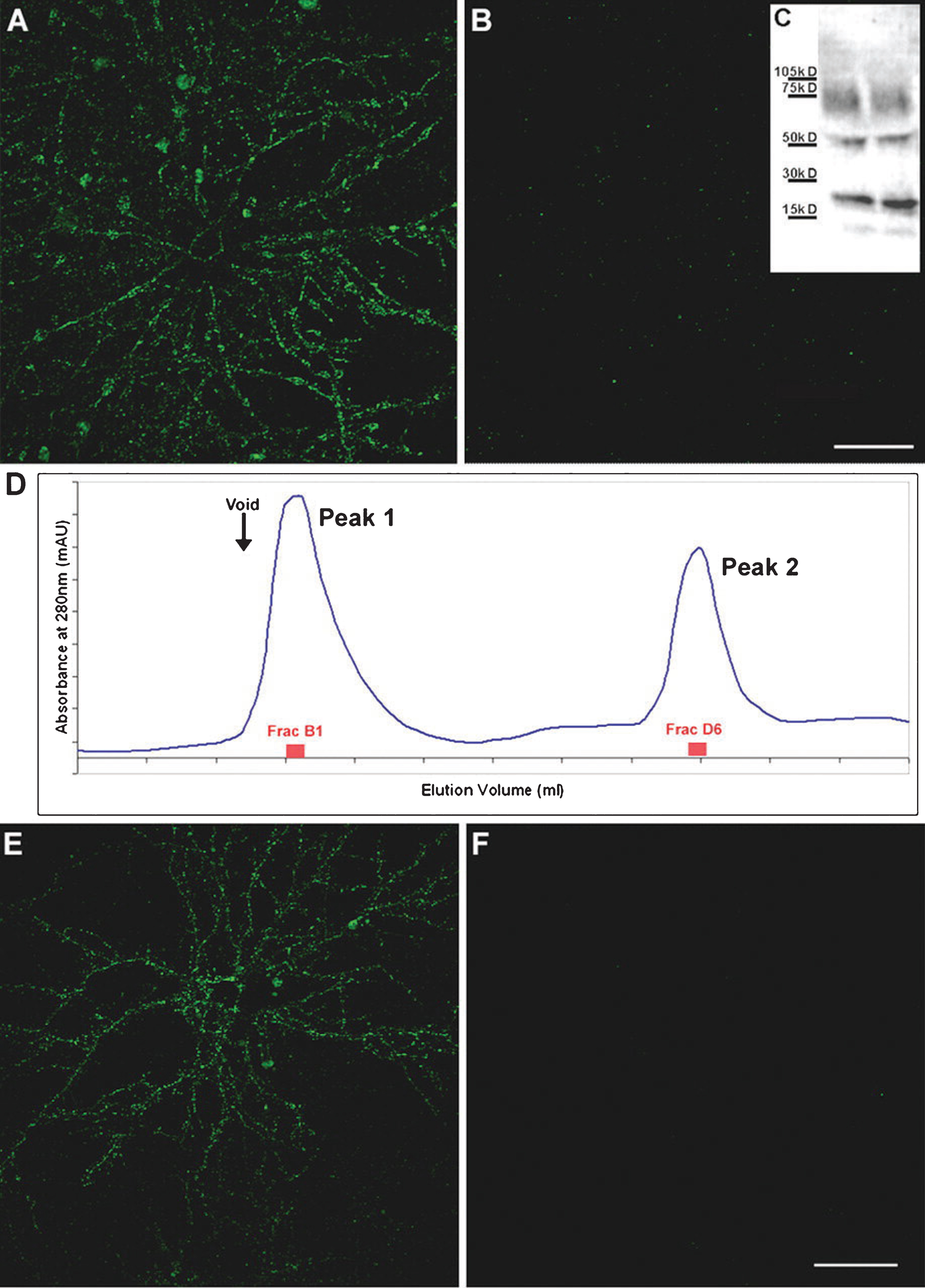 Only high-molecular weight AβOs are capable of binding cultured hippocampal neurons. Synthetic AβOs were divided into high and low molecular weight populations using 50 kDa molecular weight cutoff ultrafiltration (A-B) or size exclusion chromatography (D-F) and incubated with cultured hippocampal neurons. Only high-molecular weight AβOs bind neurons (A, E); no binding of low-molecular weight AβOs was evident (B, F). Scale bar = 40μm. Reprinted from “Synaptic targeting by Alzheimer’s-related amyloid beta oligomers” by Lacor PN, Buniel MC, Chang L, Fernandez SJ, Gong Y, Viola KL, Lambert MP, Velasco PT, Bigio EH, Finch CE, Krafft GA, and Klein WL. This was published in J Neurosci, 2004, 24(45): 10191-10200, copyright 2004; permission conveyed through Copyright Clearance Center, Inc. [16].