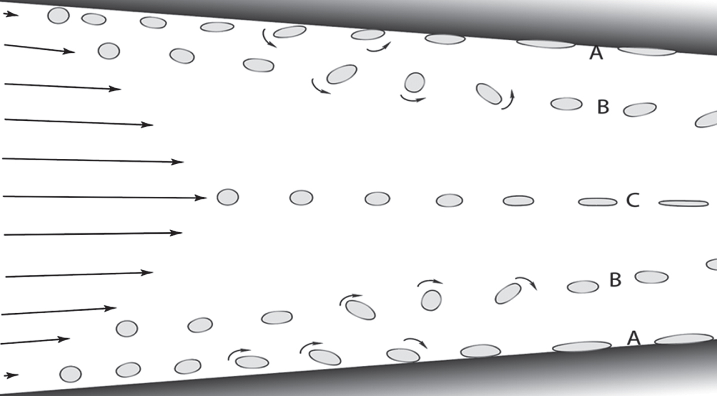 Symbolic examples of three different effects of shear in a cross section of a narrowing flow path that generates both laminar and extensional shear, e.g., between two neighboring neuron surfaces (shaded black regions). Laminar shear is generated by diminishing differences in flow rates as one moves perpendicular to the wall surface. Molecules closest to the surface experience two forces, stretching and rotation. The latter forces a stretched end of the neighboring molecule to forcibly collide with and adhere to the wall (A), depending on the flow rate and geometry of the flow channel. Those molecules near the wall that are far enough away from the wall that they cannot collide with the wall freely tumble (B) while also oscillating in length, depending on their flexibility. Molecules in the center region have negligible laminar shear. However, as the distance between the flow-confining walls narrows, extensional shear is generated, as shown by the steadily lengthening and narrowing of the molecules shown in the figure. Left arrows represent liquid flow rates and molecular symbols represent stroboscopic freeze frames as a function of flow and time. Note the anticipated migration of B molecules away from the walls and toward the center axis because shear-stressed molecules tend to preferentially migrate from regions of high shear stress toward regions of lower stress [63].