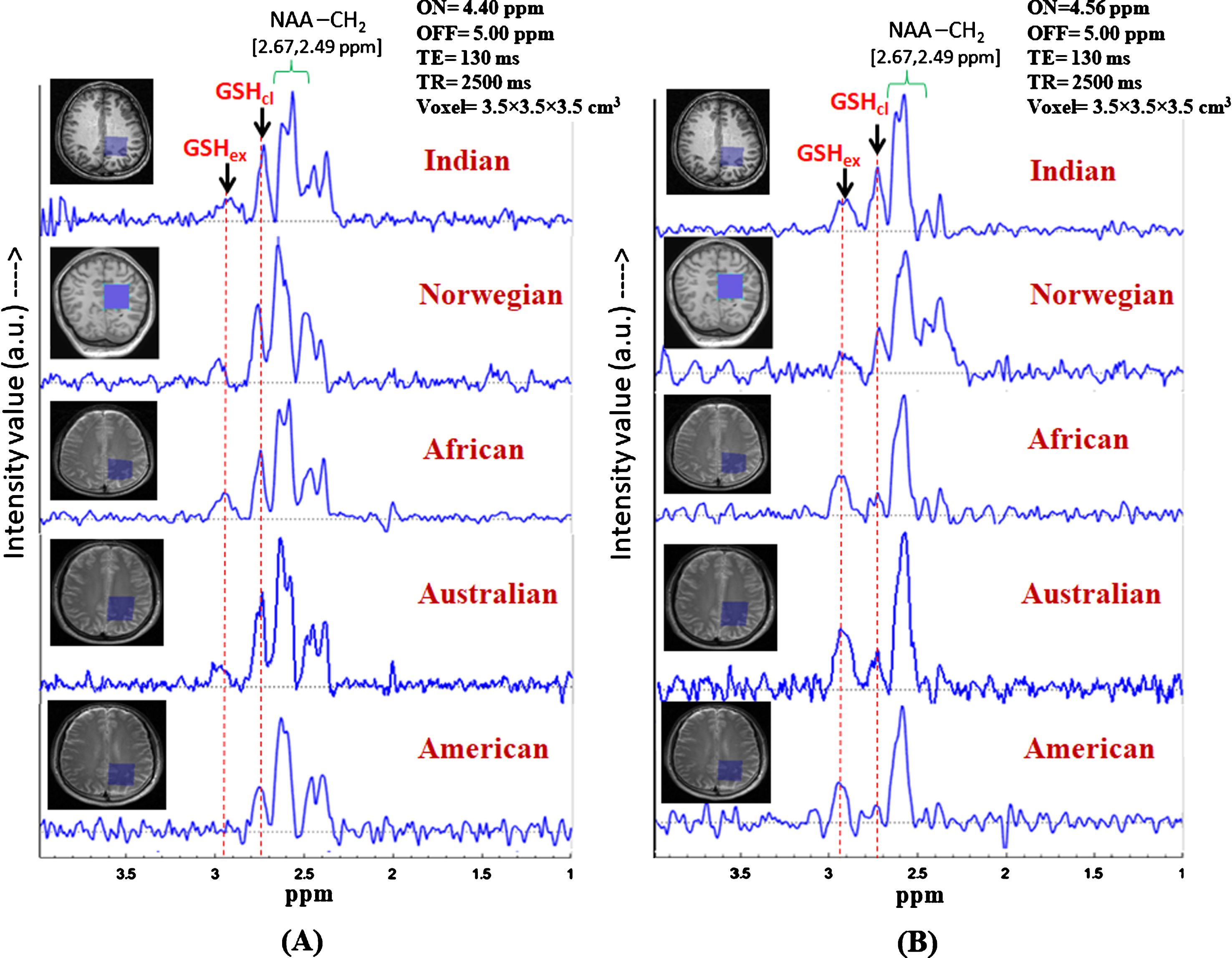 Identification of the two in vivo GSH conformer peaks in controls subjects from different continents. (Data from Indian subject, subject from African, Australian, and American origins are collected using Philips scanner at NBRC, India, and data from Norwegian subject is collected using GE scanner at Bergen, Norway). Same MRS protocol was used for data acquisition: TE = 130 ms, TR = 2500 ms, (A) MEGA-ON/OFF = 4.40 ppm/5.00 ppm and, (B) MEGA-ON/OFF = 4.56 ppm/5.00 ppm) (voxel size = 3.5×3.5×3.5 cm3 on left parietal cortex).