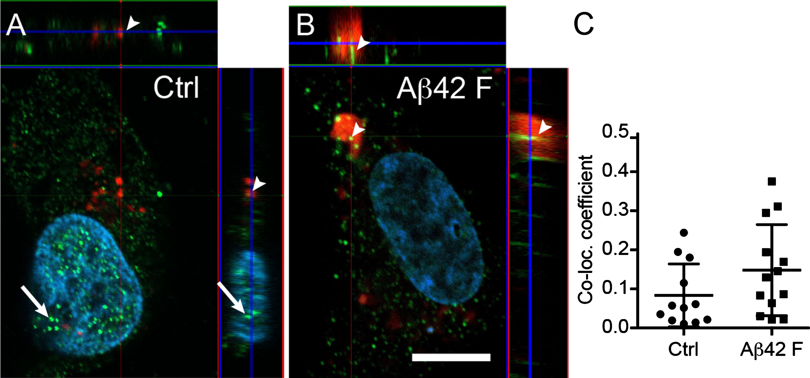 Astrocytic α-amylase can be found within the cytosol, in lysosomes and in the cell nucleus. Confocal images in (A and B) show an AMY2A immunostaining of HA exposed to Lysotracker RED DND-99 (in red indicated with arrowheads in A and B), vehicle control (Ctrl) and 10 μM Aβ42 fibrils (Aβ42 F). The AMY2A (in green in A and B) was found within the cytosol but some AMY2A (indicated with arrows in A) was also found within the DAPI stained cell nucleus (in blue). The AMY2A (arrowheads in A and B) was also found within lysosomes (red in A and B) and some of the lysosomes were enlarged in the Aβ42 F stimulated HA cells (B). Scale bar = 5 μm. Column scatter plots in (C) show the co-localization coefficient AMY2A within lysosomes in the stimulated HA. No significant change in co-localization between Aβ42 F and Ctrl stimulated HA cells was detected. The experiment was independently performed three times and 3-4 cells from each experiment and condition (in total 10 per condition) was analyzed. Data was analyzed using one-way ANOVA with Tukey post-test and presented as mean±SD.