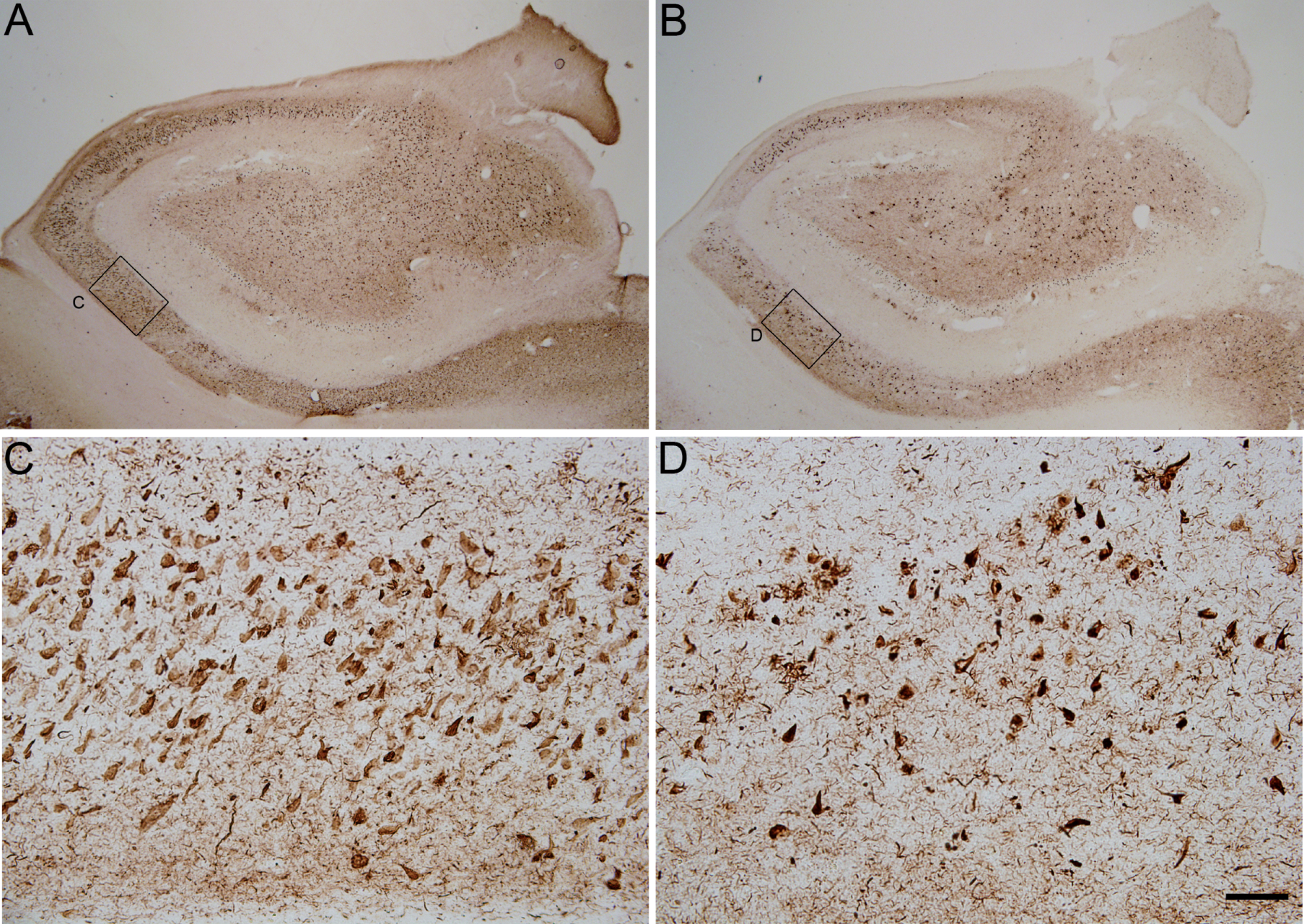 Photomicrographs showing the pattern of hyperphosphorylated tau immunostaining using pS396 (A and C) and AT100 (B and D) antibodies in two adjacent coronal sections from the hippocampus of an AD case (BCN4). Small squared zones in A and B are shown at higher magnification in C–D (CA1 field of the hippocampus). Scale bar shown in D indicates 1824 μm in A–B and 114 μm in C–D.