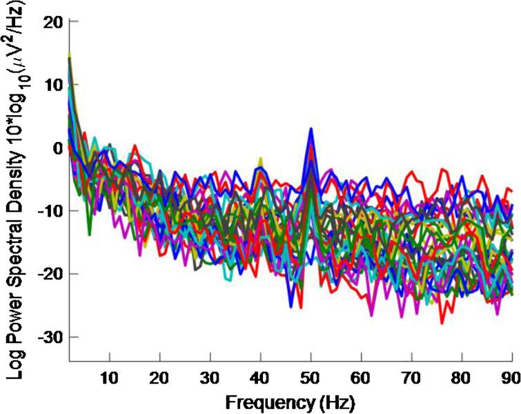 PSD for high intensity 40 Hz stimulus for healthy volunteer 3 using the first 5 s of data. The plot is noisy and it is becoming more difficult to see a 40 Hz response.