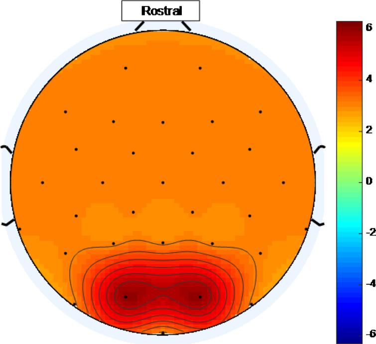 Example of a scalp map that could be generated using an ideal high intensity 40 Hz stimulus where, purely for illustrative purposes, an ideal threshold of ∼3 has been assumed. The entire head is shaded with tints represented by numbers above an ideal threshold on the color scale.