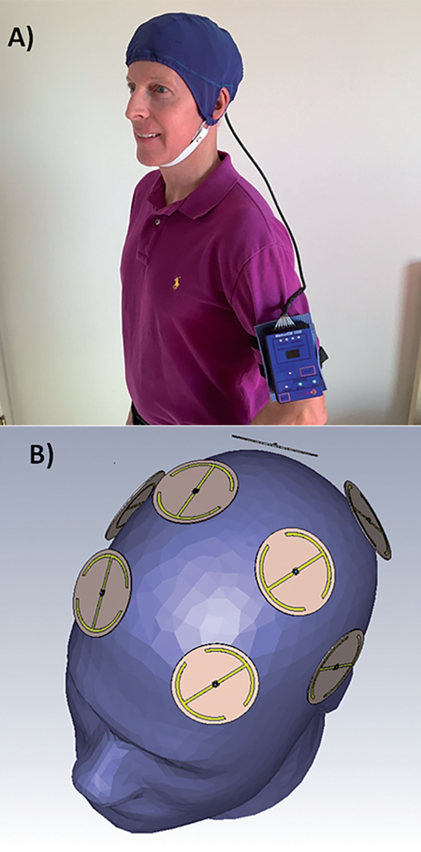 A) A MemorEMTM head device being worn by a subject. B) Position of the eight electromagnetic emitters embedded between the device’s two-layered head cap. Emitters collectively provide global forebrain TEMT via rapid sequential emitter activation.