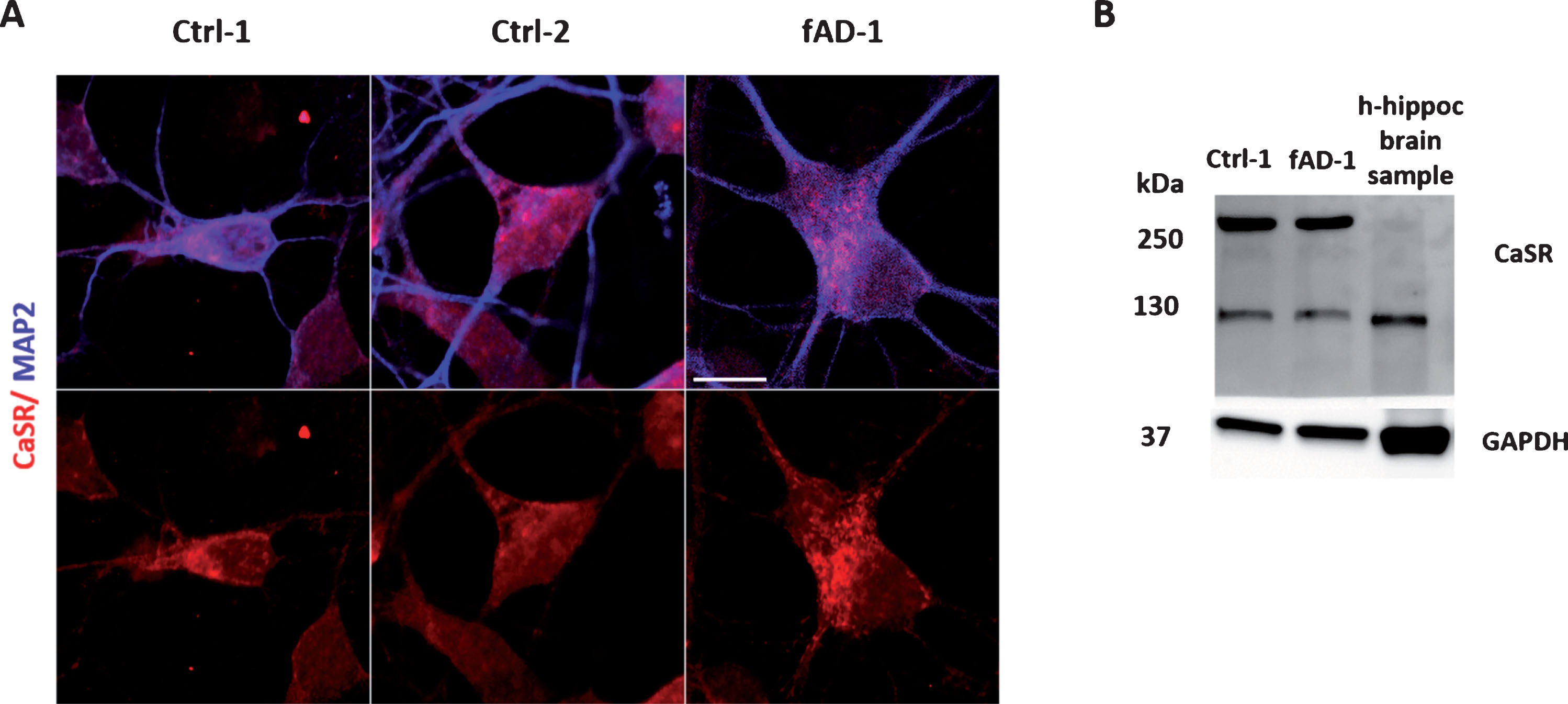 CaSR expression in differentiated neuronal cultures. A) Immunocytochemical analysis showing the CaSR expression (in red) in neurons, co-stained with MAP2 (in blue); for color images see the online version. B) Representative western blot of control and fAD lysates demonstrating the receptor positive bands at ∼130 kDa and ∼260 kDa which should represent the monomeric and dimeric forms of CaSR. Human control adult hippocampal brain lysate has been loaded as positive control of CaSR expression in human brain.