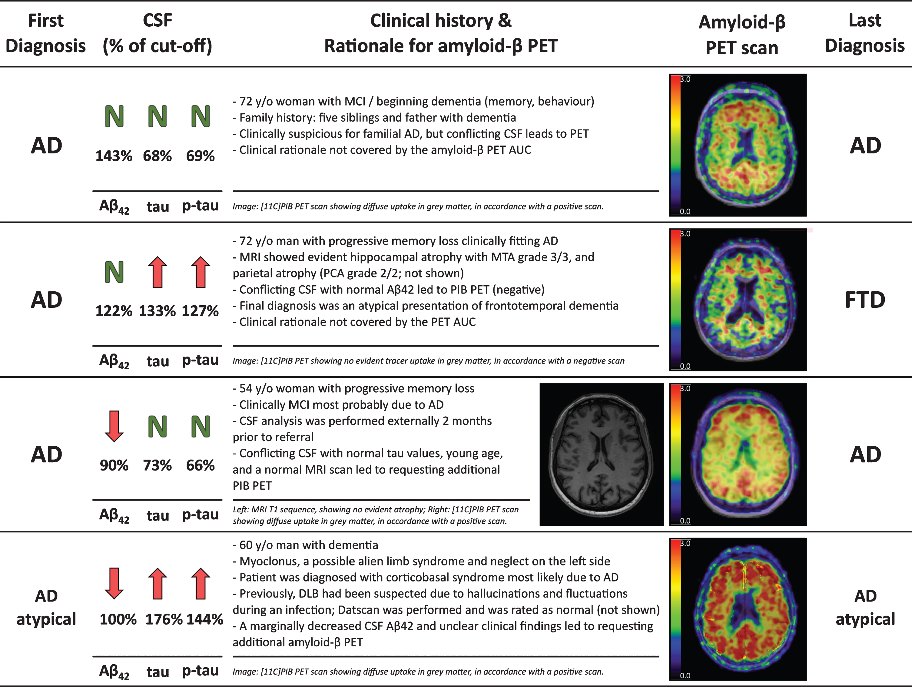 Four case reports illustrating the clinical reasoning for requesting an additional amyloid-β PET.