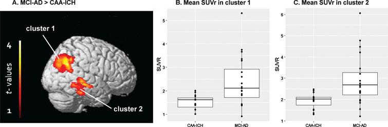 Groups compared using a voxel-wise approach. A) Statistical parametric map displaying SUVr differences between the groups (p < 0.05 FWE-corrected). B) Mean SUVr values in cluster 1. C) Mean SUVr values in cluster 2.