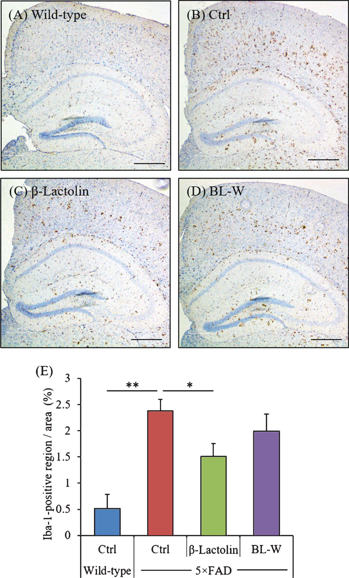 Effects of β-lactolin on microglial infiltration in 5×FAD mice. Transgenic 5×FAD and wild-type male mice aged 2.5 months were fed a diet with or without 0.05% w/w β-lactolin or 5% w/w β-lactolin-rich whey enzymatic digestion (BL-W) for 3.5 months. A-D) Representative immunohistochemistry images for Iba-1 in wild-type mice, transgenic control mice (Ctrl), and transgenic mice fed a diet containing β-lactolin or BL-W. Scale bars, 400μm. E) Percentage of the Iba-1-positive area detected by immunohistochemistry in the cortex in transgenic control mice (Ctrl) and transgenic mice fed a diet containing β-lactolin or BL-W. Data are presented as means±SEM (sample size: wild-type mice, 10; control transgenic mice, 10; transgenic mice fed with β-lactolin, 11; or transgenic mice fed with BL-W, 10). p-values shown in the graph were calculated by one-way ANOVA followed by the Tukey–Kramer test. *p < 0.05.