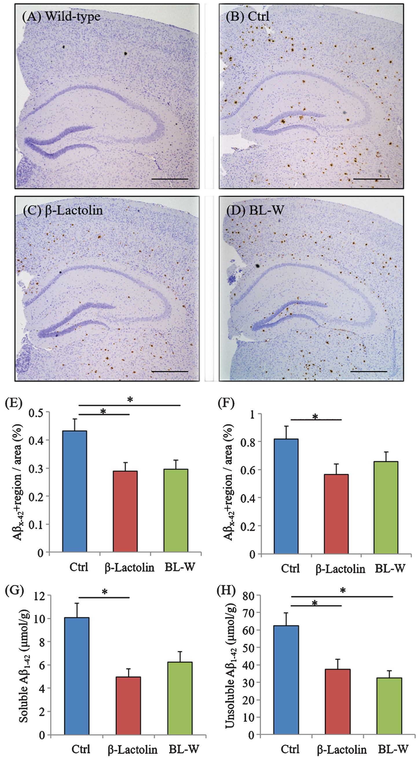 Effects of β-lactolin on Aβ deposition in 5×FAD mice. Transgenic 5×FAD and wild-type male mice aged 2.5 months were fed a diet with or without 0.05% w/w β-lactolin or 5% w/w β-lactolin-rich whey enzymatic digestion (BL-W) for 3.5 months. A-D) Representative immunohistochemistry images for Aβ1-42 in wild-type mice and transgenic mice with or without β-lactolin or β-lactolin-rich whey enzymatic digestion. Scale bars, 400μm. E, F) Percentage of the Aβ1-42-positive area detected by immunohistochemistry in the cortex and hippocampus in transgenic control mice (Ctrl) and transgenic mice fed a diet containing β-lactolin or BL-W. G, H) The levels of TBS-soluble or TBS-insoluble/TBS-T soluble Aβ1-42 in the frontal cortex. Data are presented as means±SEM (sample size: wild-type mice, 10; control transgenic mice, 10; transgenic mice fed with β-lactolin, 11; or transgenic mice fed with BL-W, 10). p-values shown in the graph were calculated by one-way ANOVA followed by the Tukey–Kramer test. *p < 0.05.