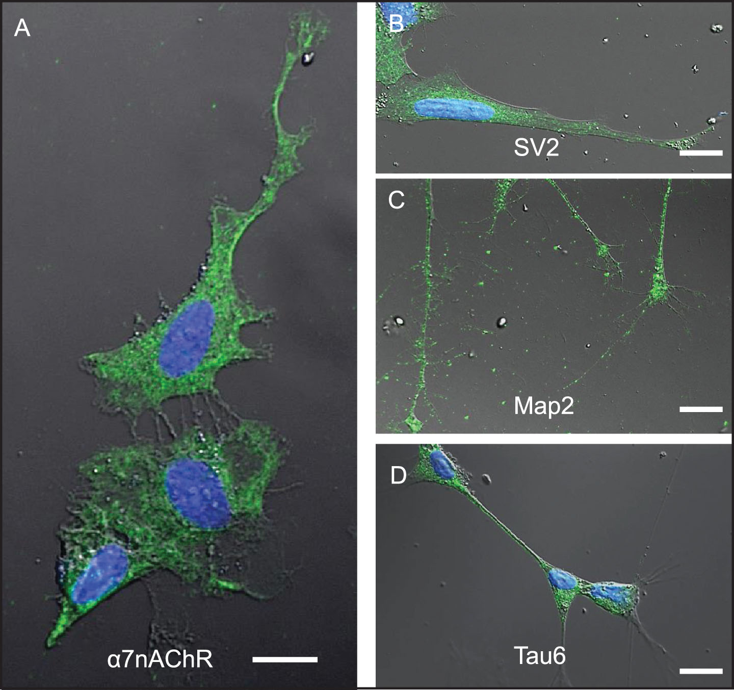 Differentiated SH-SY5Y cells are a useful model system to study mechanisms associated with neuronal Aβ42 internalization. SH-SY5Y cells differentiated by treatment with retinoic acid for 72-h. A-D) Differentiation was confirmed by changes in cell shape, extension of neuritic processes, and detection of robust expression of the following neuronal markers of differentiation using ICC: (A) α7nAChR; (B) synaptic vesicle 2a (SV2); (C) microtubule-associated protein 2 (Map-2); and (D) tau6. Scale bar = 5 μm.