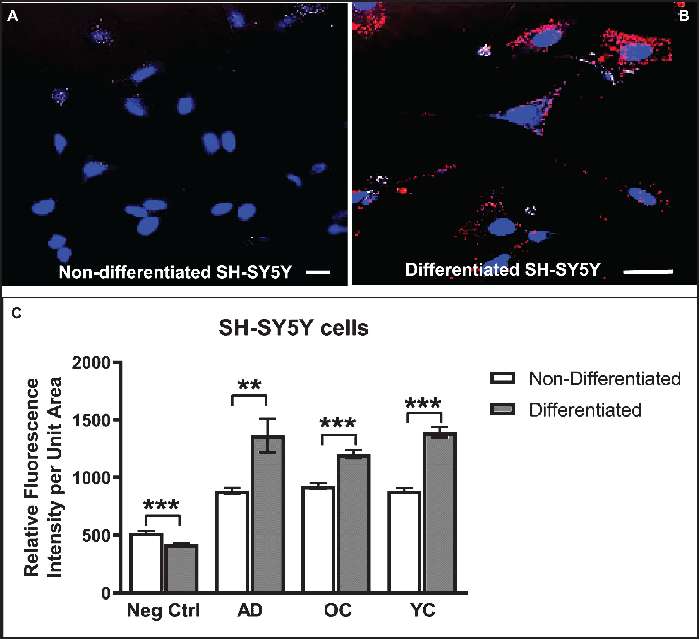 Differentiated SH-SY5Y cells show increased reactivity to IgG autoantibodies present in human serum. A, B) Confocal images of non-differentiated (A) and differentiated (B) SH-SY5Y cells treated with human serum (diluted 1:50) in medium for 24 h and then immunostained with Cy3-labeled (red) anti-human IgG antibodies and counterstained with Hoechst stain (blue) to highlight nuclei. C) Differentiated cells show increased binding of serum IgG over that of non-differentiated cells. Unexpectedly, the extent of IgG binding in cells treated with serum from an AD patient did not differ significantly from an older non-demented subject or younger control. Controls (Ctrl) were performed with omission of serum and addition of secondary antibody. Scale bar = 10 μm. ***p < 0.001. AD, Alzheimer’s disease serum; OC, old-aged matched, non-demented control; YC, younger, non-demented control.