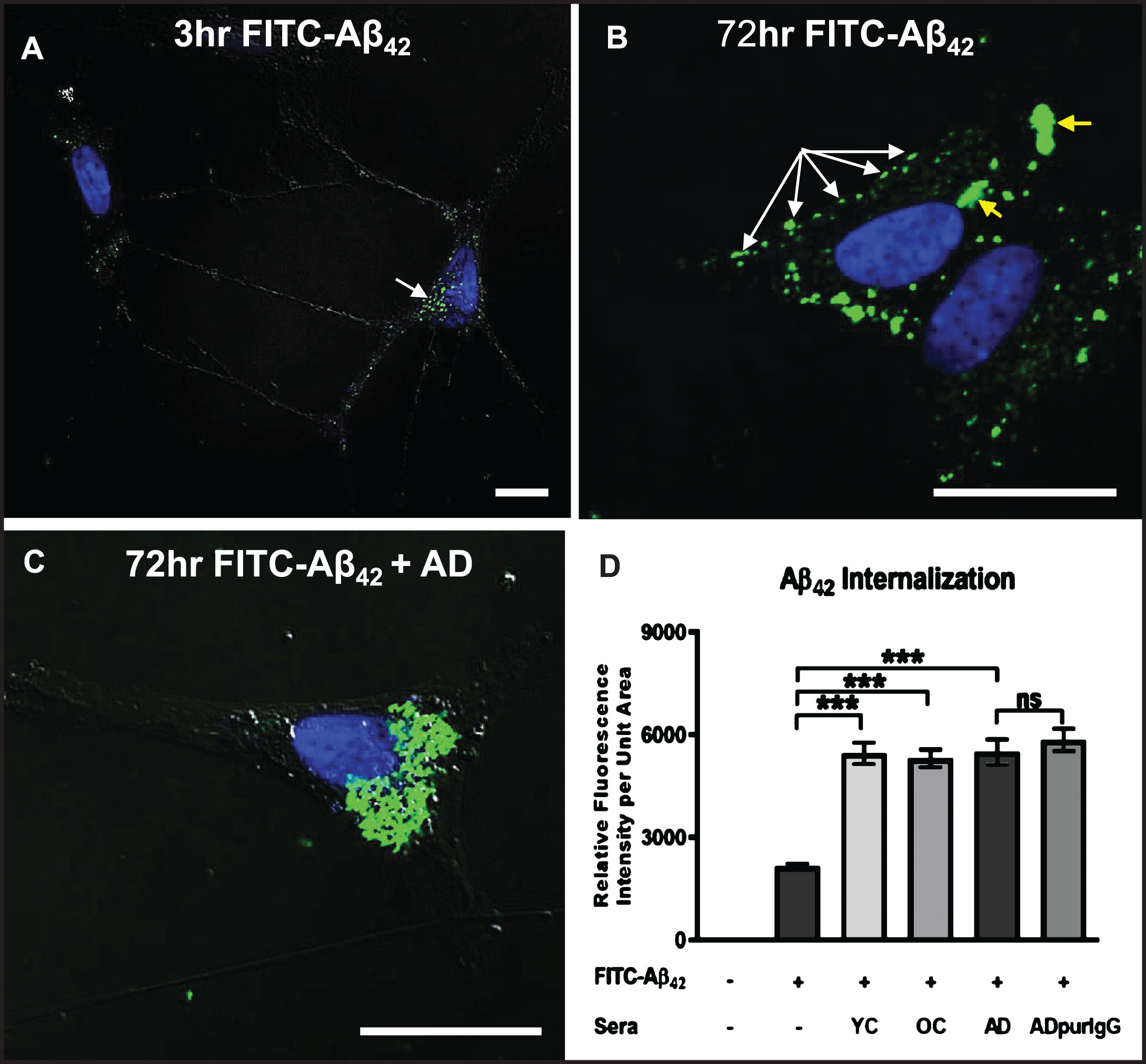 Internalization of exogenous Aβ42 is enhanced by binding of IgG autoantibodies. A, B) Differentiated SH-SY5Y cells treated with a physiologically relevant dose (100 nM) of FITC-labeled Aβ42 for 3 and 72 h in medium without human serum showing that Aβ42 internalization can occur in the absence of serum. A) At 3 h, FITC-Aβ42 was localized to small, dispersed and uniformly sized granules. B) As is typically seen in Aβ42-overburdened neurons in regions with AD pathology, a significant fraction of internalized Aβ42 was concentrated within aggregates at 72 h. C) Addition of AD serum to media containing 100 nM FITC-Aβ42 increased the rate and extent of Aβ42 internalization with very little detected on the cell surface. D) Quantification of the effects of different human sera on the rate and extent of FITC-Aβ42 internalization after 72 h of treatment. Exposure of differentiated SH-SY5Y cells to 100 nM FITC-labeled Aβ42 in media without serum (controls) resulted in detection of a relatively low level of intracellular Aβ42. Addition of human serum to the media greatly increased the rate and extent of FITC-labeled Aβ42 internalization observed at 72 h. Comparison of the effects of serum from an AD patient, an age-matched non-demented subject, and a younger non-demented control individual revealed no significant differences in the amount of Aβ42 accumulation over 72 h, and intracellular Aβ42 levels in these groups were all significantly higher than in cells treated with Aβ42 alone. In addition, IgG purified from AD serum showed comparable Aβ42 internalization rates to that of whole serum, suggesting that, among serum components, IgG is largely responsible for the observed Aβ42 internalization in SH-SY5Y cells. Scale bar = 10 μm. ***p < 0.001. AD, Alzheimer’s disease serum; OC, old-aged matched, non-demented control; YC, young-aged, non-demented control; ADpurIgG, purified IgG from AD sera; white arrow, newly internalized/plasma-membrane bound Aβ42; yellow arrow, aggregates of Aβ42-containing granules.