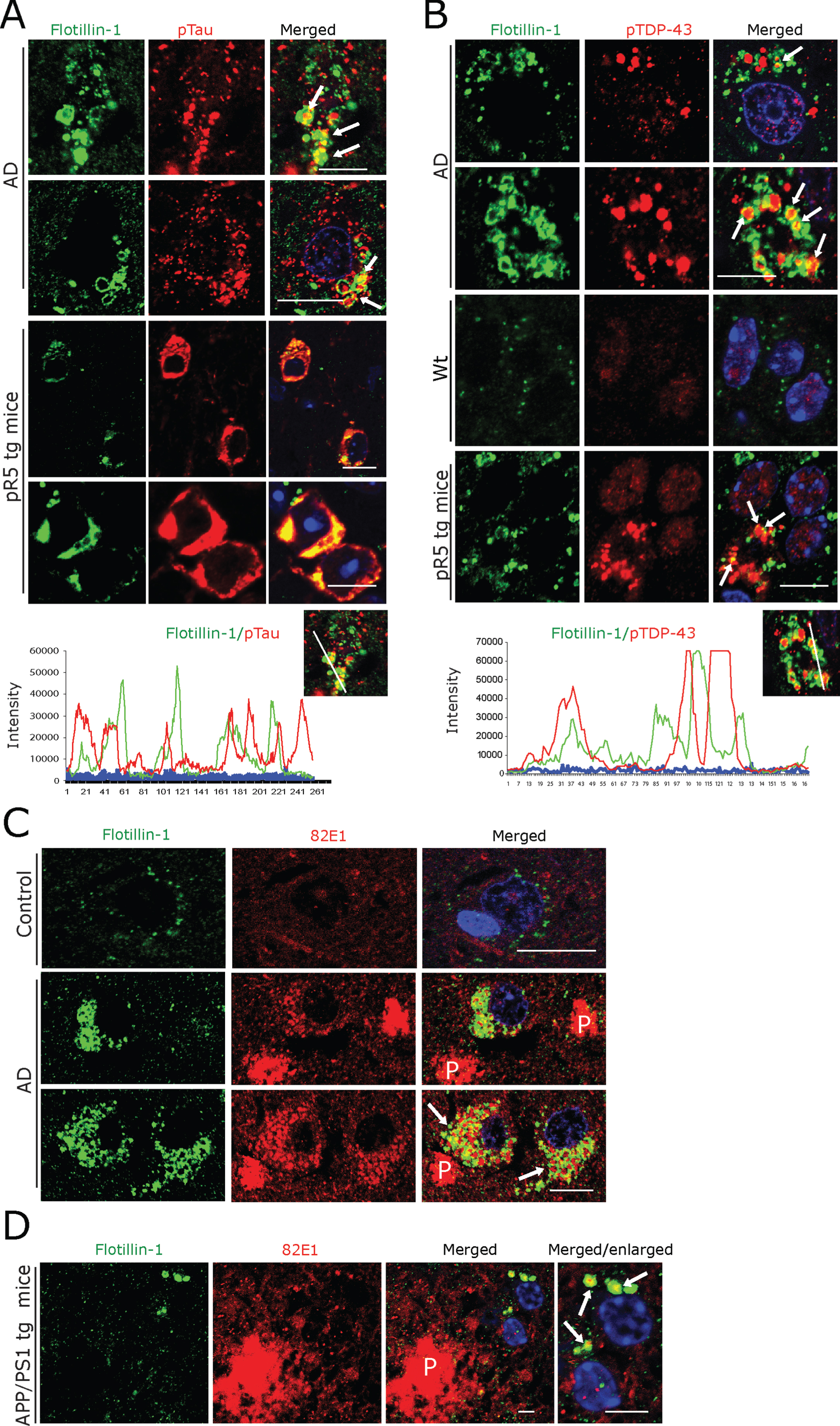 A, B) Double immunofluorescence for Flotillin-1 together with pTau- (A) and pTDP-43 (B), demonstrating that these aggregates are often co-localized with and/or are enclosed by Flotillin-1 labeled vesicles (arrows) in AD patient subicular and in pR5 tg mice CA1-subicular (lower panels), neurons, maximum intensity projections (below) to show the co-localization. Scale bars: 15μm. C) Double immunofluorescence of Aβ oligomer (82E1 antibody) and Flotillin-1. There was a rather rare, somewhat arbitrary coincidence of Flotillin-1-labeled structures with 82E1 immunoreactivity within human AD subicular neurons (arrows) in the vicinity of 82E1-labeled Aβ plaques (P). Scale bars: 15μm. D) In APP/PS1 tg mice 82E1 immunoreactive intracellular material is often co-localized with Flotillin-1-labeled vesicles (arrows) within subicular neurons in the vicinity of Aβ plaques (P). Scale bars: 10μm.