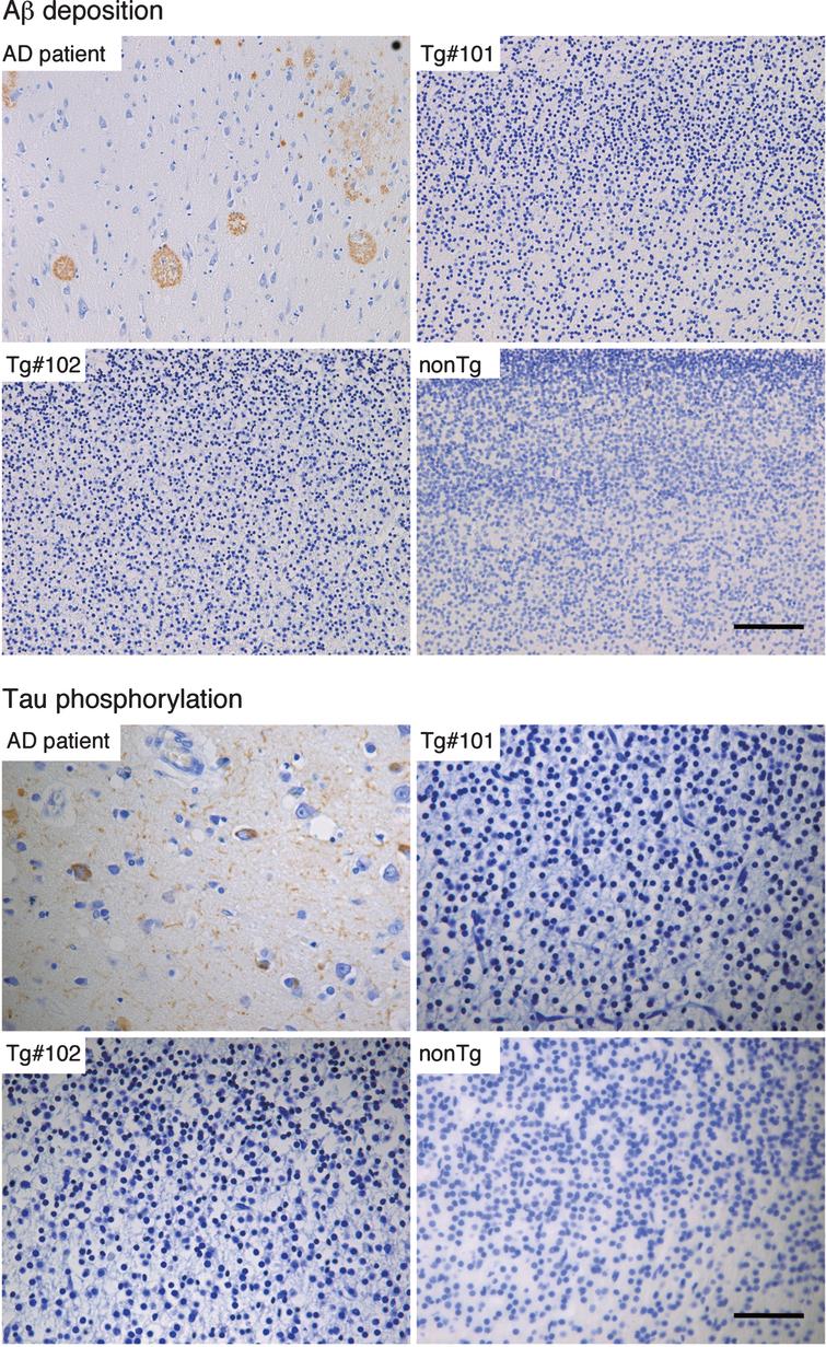 Immunohistochemistry for Aβ and phosphorylated tau in the brains of wild and the Tg#1 and Tg #2 cynomolgus monkeys compared with an Alzheimer’s disease case. Detection of AD-related pathologies in the cerebral cortex of aborted Tg and age-matched non-transgenic fetuses. The sections of the brain tissues from the monkey embryos and an AD patient were stained with anti-Aβ (upper) and anti-phosphorylated tau antibodies (lower). Scale bar = 50 μm.