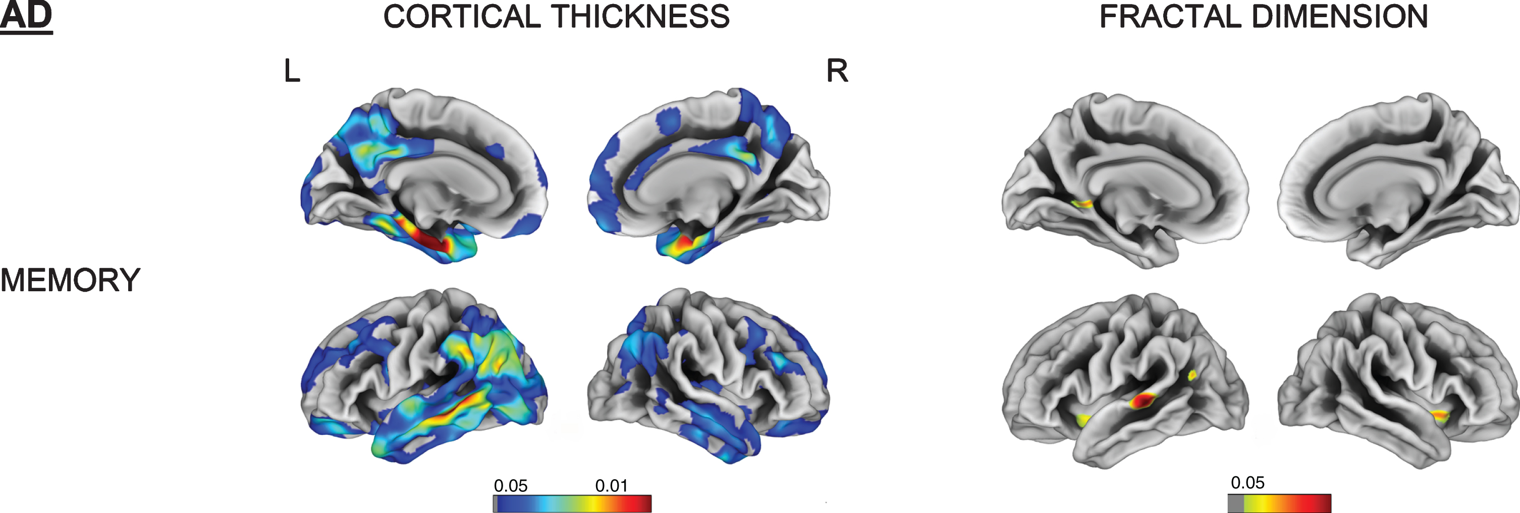 Vertex-wise cortical thickness and fractal dimension correlate of memory impairment for the AD group (FDR-corrected p < 0.05). L, left; R, right.