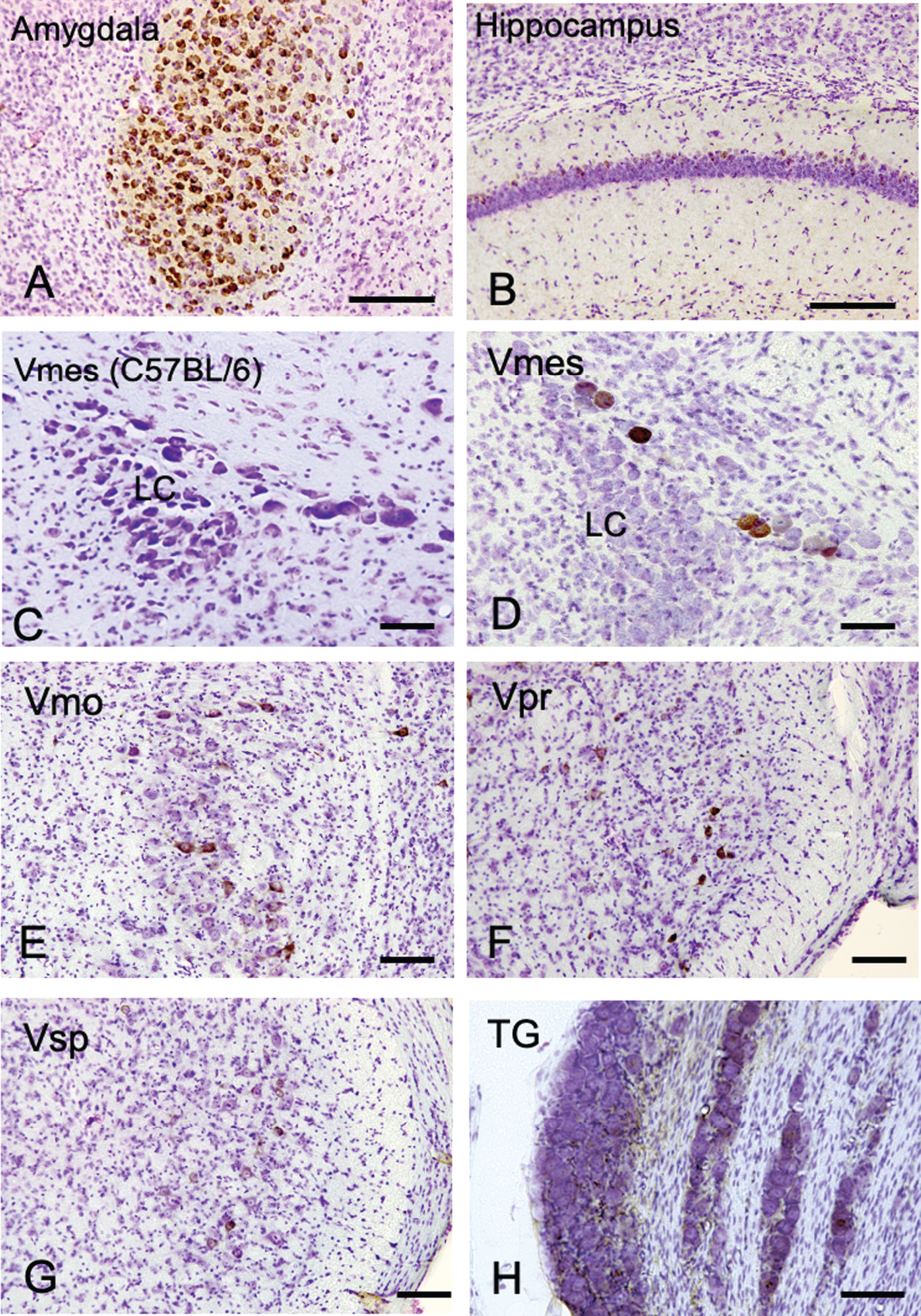 The distribution of Aβ-IR neurons in the cerebrum and the trigeminal nervous system in 4-month-old 3×Tg-AD mice using an anti-Aβ antibody (6E10). A, B) In the positive control, strong Aβ-IR neurons were found in amygdala, and relatively weak Aβ immunopositivity was observed in the hippocampus. C) In wild-type C57BL/6 mice, which were used as negative controls, no Aβ-IR Vmes neurons were found. D–H) In the trigeminal nervous system intensely Aβ-IR neurons were found in the trigeminal mesencephalic nucleus (Vmes), weak scattered Aβ-IR neurons were observed in the trigeminal motor nucleus (Vmo), trigeminal principal nucleus (Vpr), and trigeminal spinal nucleus (Vsp). Small number of Aβ-IR neurons were found in the trigeminal ganglion (TG). The sections were counterstained with cresyl violet. LC, locus coeruleus. Scale bars: A, B, E-H, 200 μm; C, D, 50 μm.