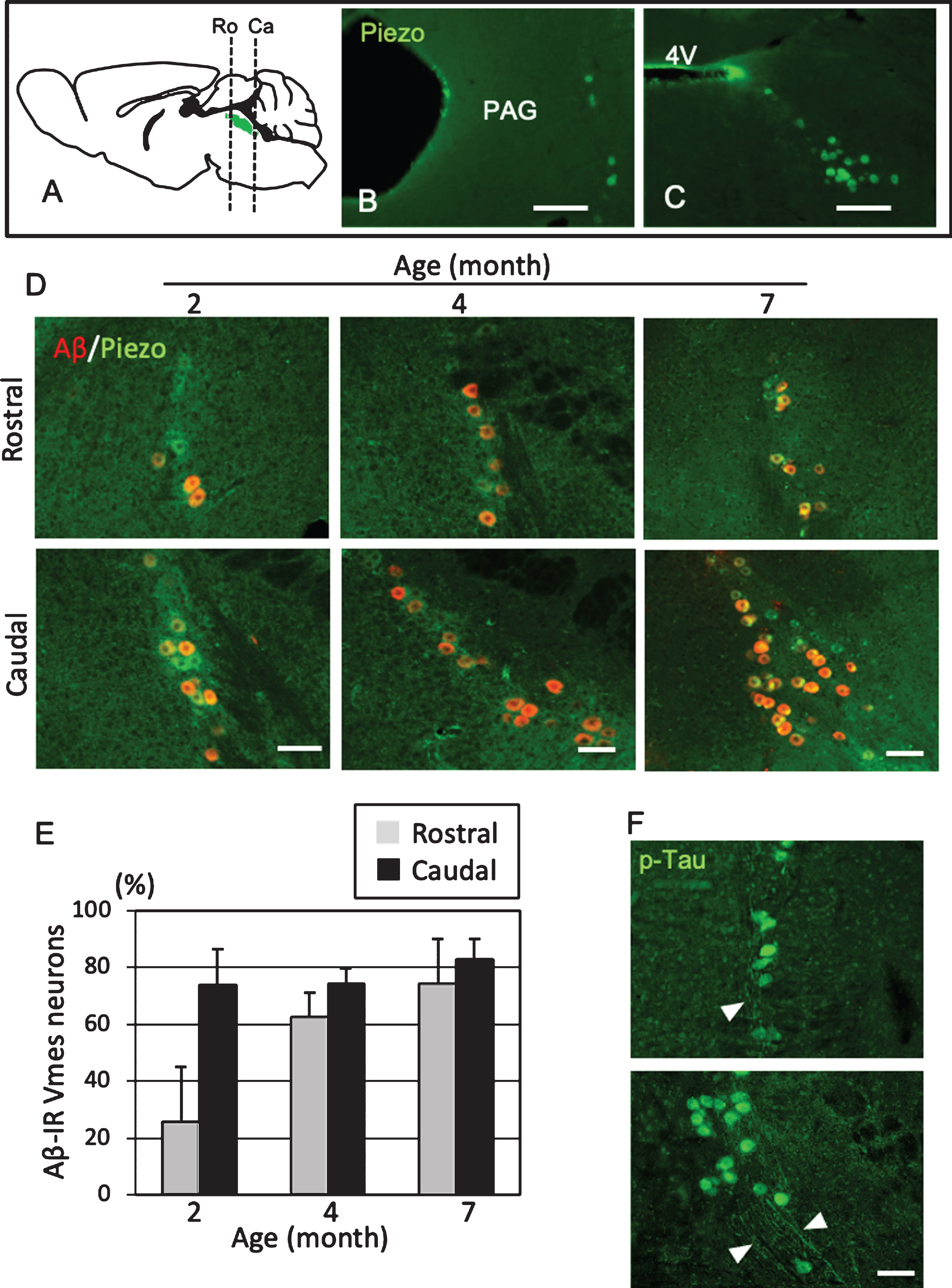 Position- and age-dependent amyloid β (Aβ) deposition in Vmes neurons in 3×Tg-AD mice. A) The positions of the histological sections from the rostral (Ro) and caudal (Ca) sides of the Vmes (Green). B, C) Immunofluorescence images of Piezo2 inVmes neurons in the rostral (B) and caudal (C) regions. PAG, periaqueductal gray; 4V, 4th ventricle. D) Immunofluorescence images of Aβ and Pezo2 in the rostral (Ro) and caudal (Ca) parts of the Vmesin 2-, 4-, and 7-month-old 3×Tg-AD mice. E) Age-dependent ratios of Aβ-IR Vmes neurons in the rostral and caudal regions of the Vmes. The data are the means±SDs, n = 10. F) p-Tau-IR neurons in 7-month-old 3×Tg-AD mice. The rostral (upper) and caudal (lower) parts of Vmes. The arrowheads indicate p-Tau-IR axons of Vmes neurons. Scale bars: B, C, 200μm; D, F, 50μm.