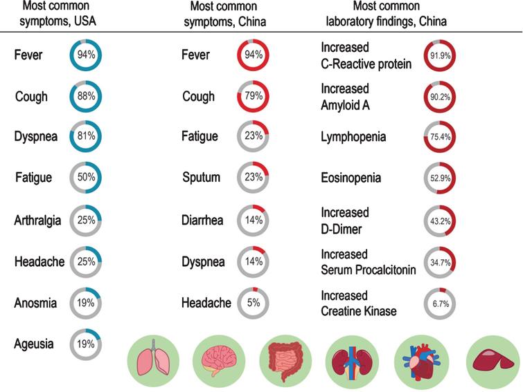 Most common COVID-19 symptoms in US and China. Most common laboratory findings in COVID-19 in China [31, 43–45]. Illustrated by Dr. Joe Bolanos.