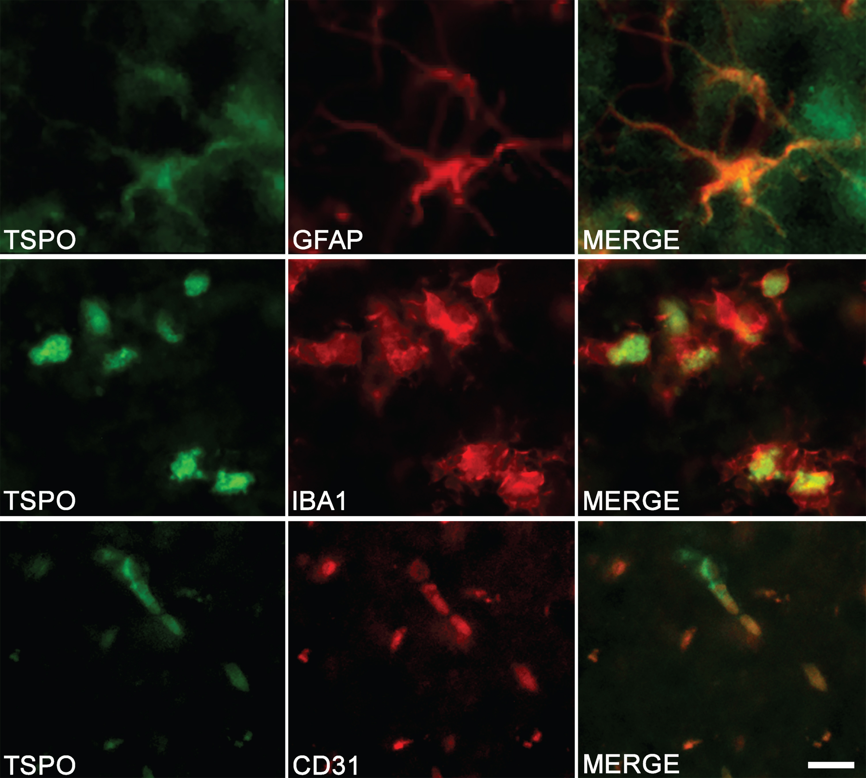 Cell origin confirmation of TSPO expression in the hippocampus of TgF344-AD rats. Double-immunofluorescence was performed with antibodies directed against TSPO (green color) and specific cell markers (red color). Merge images demonstrate the colocalization of TSPO with astrocytes (GFAP), microglia (IBA1), and endothelial cells (CD31). Scale bar: 10μm.