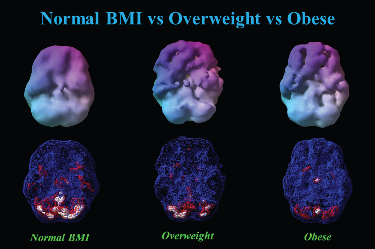 This figure showed 3-D renderings of resident perfusion averaged across normal BMI (BMI = 23), overweight (BMI = 29), and obese (BMI = 37) men, each 40 years of age.