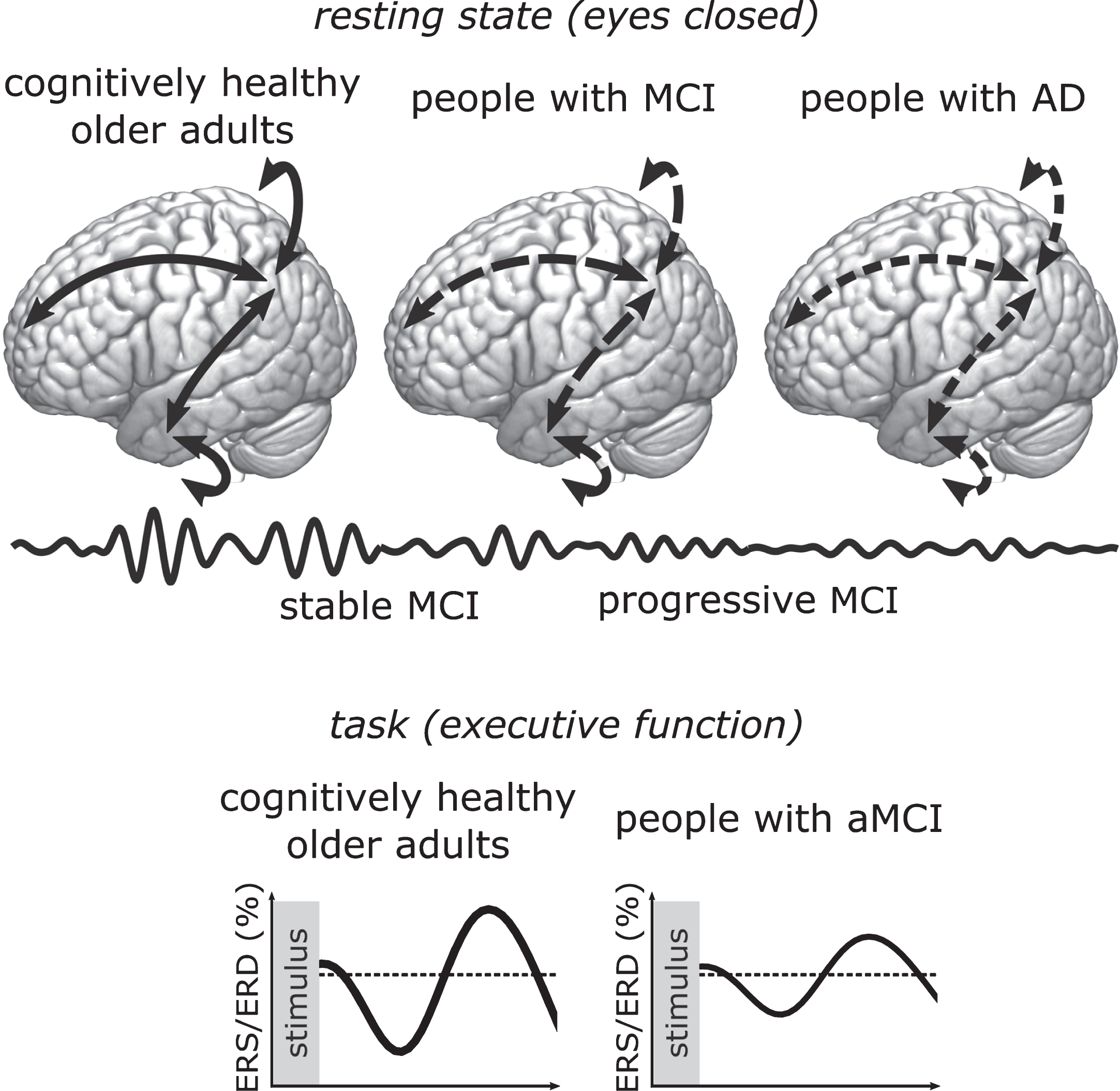 Schematic summary of most consistent findings showing lower power of alpha oscillations and connectivity of parietal areas during rest in people who are further along the continuum of cognitive decline (top panel), and lower reactivity to task stimuli in people with aMCI compared to cognitively healthy older adults (bottom panel). Arrows represent functional connectivity, and the amplitude of waves the power of alpha oscillations. Dashed arrows represent lower functional connectivity.