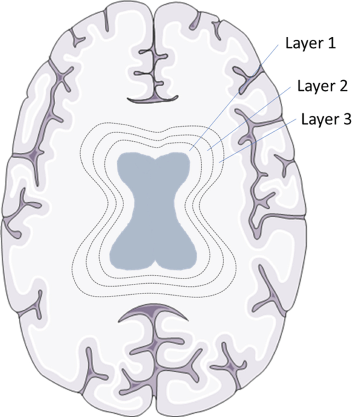WMH layers in a schematic overview. Brain tissue was divided into 20 layers, from ventricles to the skull, with each layer accounting for 5% of the total distance between ventricles to the skull. To exemplify this division the first three circular layers around the ventricles are shown in this schematic picture. Brain section image was modified from Smart Servier Medical Art, https://smart.servier.com.