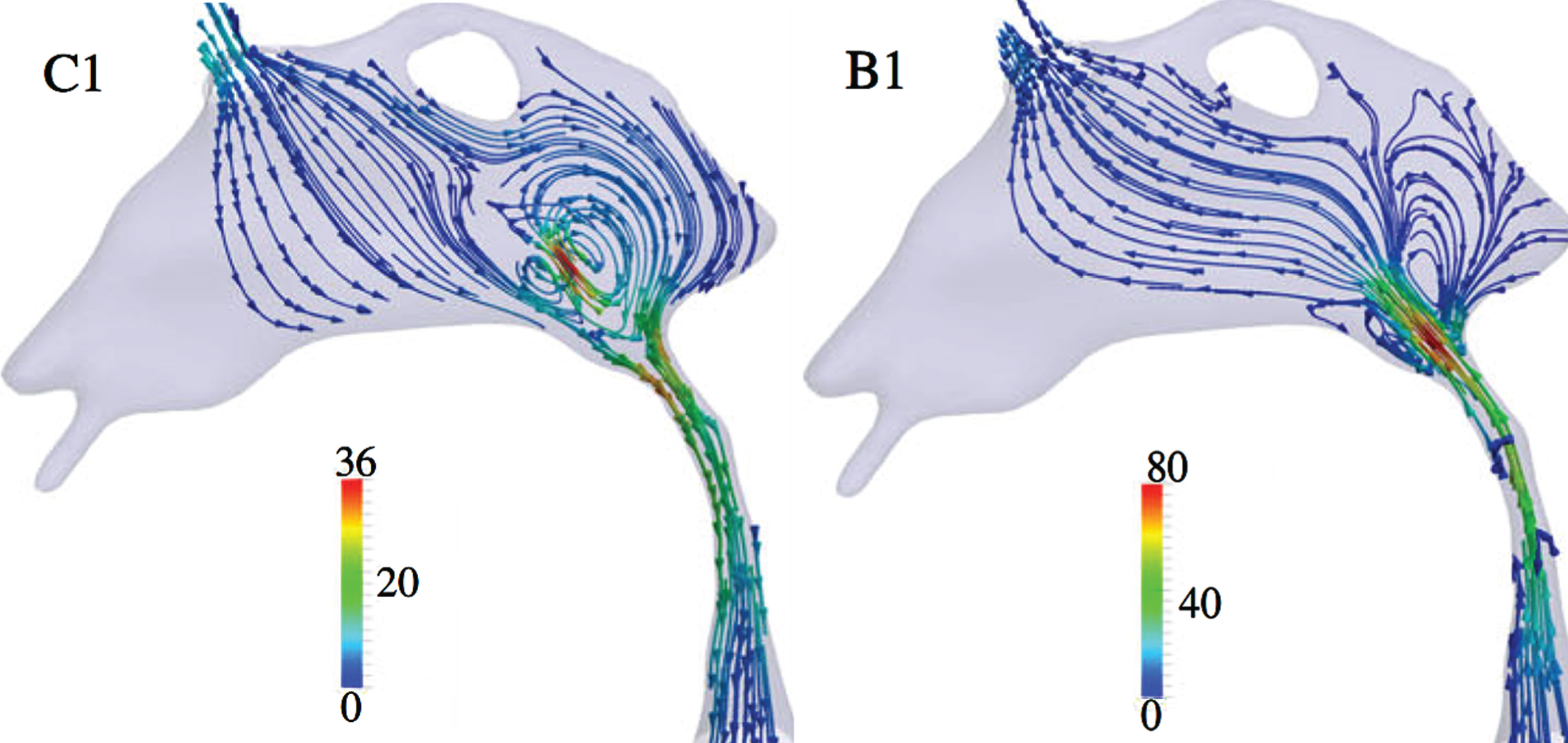Cyclic reciprocal CSF flow directions and rates in the third ventricle (top), cerebral aqueduct (CA) (middle tube), and top of third ventricle (bottom, widening) at two time points in the cardiac cycle, showing reversals in CSF flow direction (C1-flow toward fourth ventricle; B1-flow toward third ventricle). Flow rates are calculated from MRI data and hydrodynamic computations [39]. CSF flow rates are in mm/s–1 according to color coded lines and keys. Modified from [39] under Creative Commons CC-BY license.