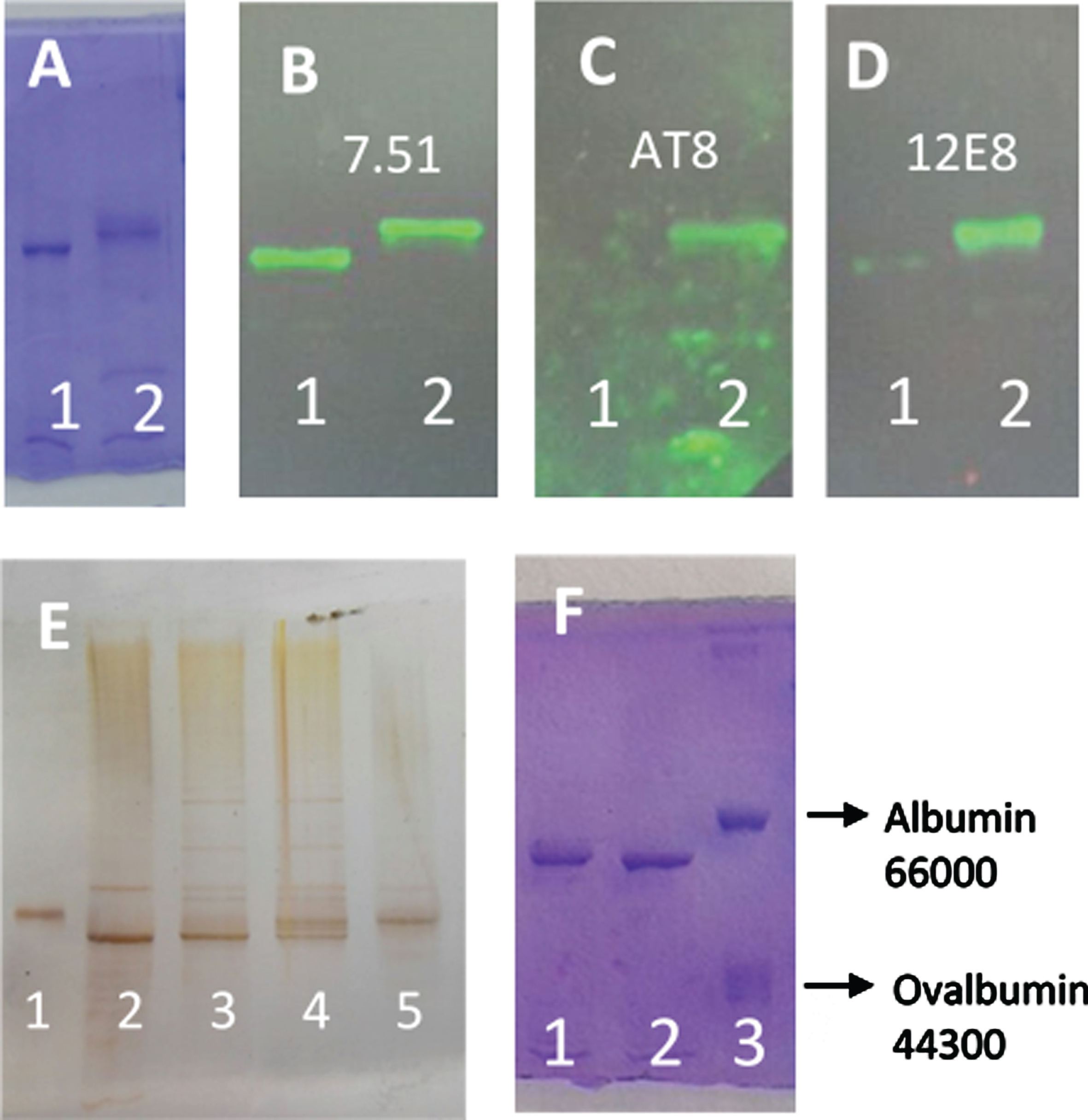 SDS-PAGE (8% of polyacrylamide) of different forms of tau protein. A) Lane 1, tau protein (0.05 mg/ml) incubated for 4 h at 37°C in the presence of MgCl2 (10 mM), EGTA (0.25 mM), 2-mercaptoethanol (0.25 mM), Hepes (5 mM), and NaCl (50 mM), pH 7. Lane 2, the same tau protein incubation as Lane 1, but in the presence of ATP (2 mM) and C-PKA (4 units). B-D) Tau protein incubated as in (A) showing the western blots using antibody 7.51 to total tau (B), AT8 to Ser 202 and Thr 205 (C), and 12E8 to Ser 262 and Ser 356 (D). E) Silver stained of different forms of tau protein. Lane 1, Albumin used as a control. Lane 2, tau protein. Lanes 3 and 4, tau protein (3.6 ng/μl) incubated with ATP (5 mM) and C-PKA for 2.5 h (lane 3) and 17 h (lane 4). Lane 5 shows the phosphorylated tau protein prepared as described in the Materials and Methods. The amounts of tau and albumin loaded in lanes 1 and 2 were approximately 70 and 60 ng respectively. F) shows tau protein (0.05 mg/ml) incubated for 1 h with ATP 0.1 mM in the absence (lane 2) or the presence of C-PKA (lane 1). Lane 3 shows a mixture of bovine serum albumin and ovalbumin used as controls.