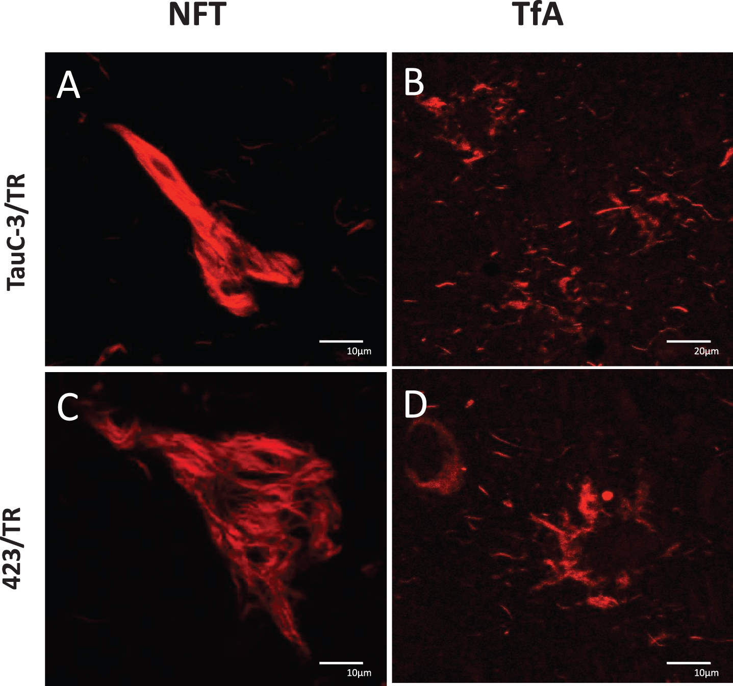 Absence of tau truncation in PSP: A, B) TauC-3 and C, D) 423. Lesions labeled by TR: A) iNFT, C) eNFT, and in B, D) tufted astrocytes. Scale bars, 10 μm, except for (B), 20 μm.