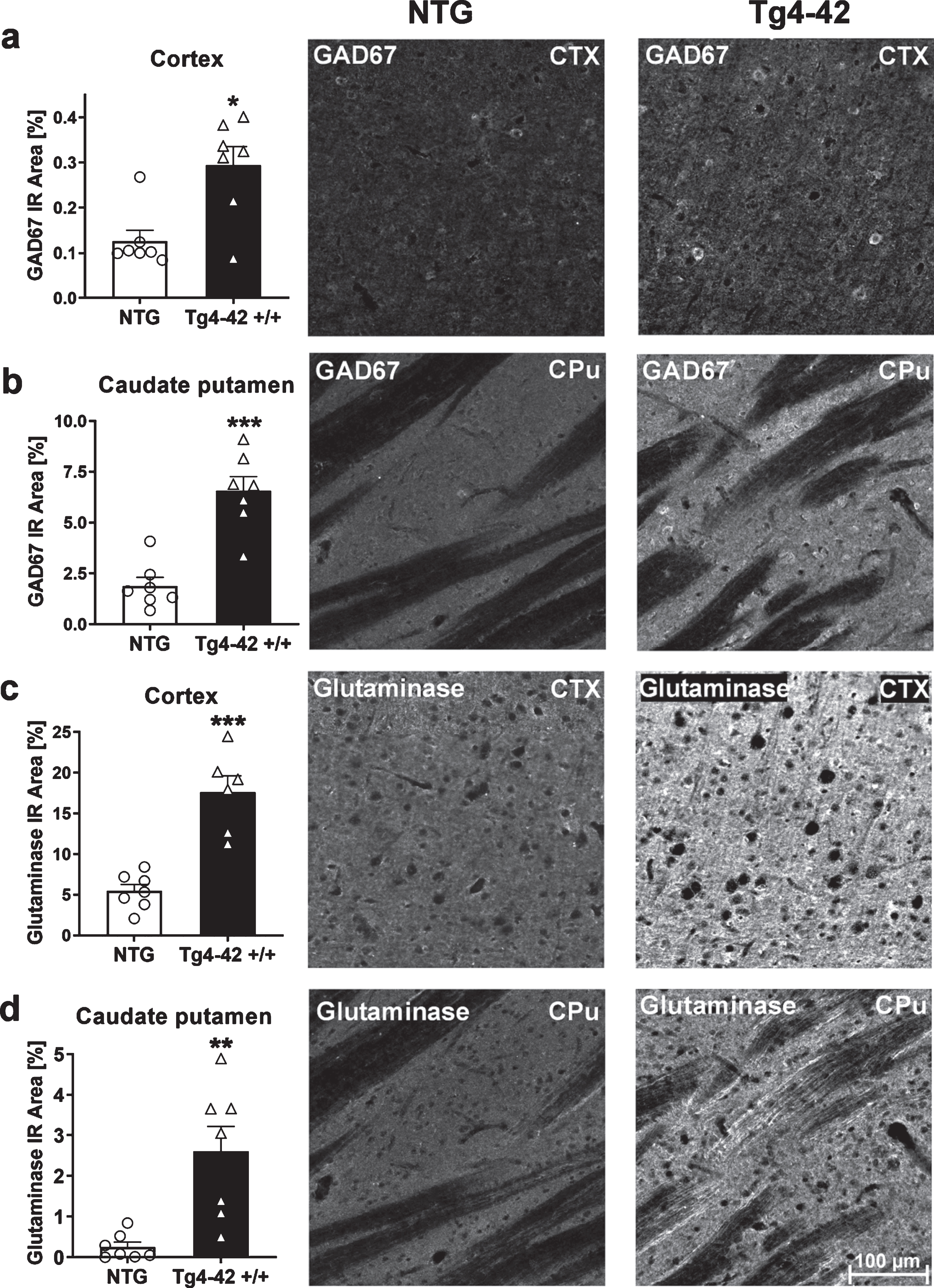 Expression of glutamate-decarboxylase (GAD67) and glutaminase in 9-month-old Tg4-42 +/+ mice. Quantitative GAD67 expression in cortex (CTX) (a) and caudate putamen (CPu) (b) and glutaminase expression in cortex (c) and caudate putamen (d) shown as immunoreactive (IR) area in percent. Representative images of NTG and Tg4-42 +/+ brain sections. Scale bar 100μm for all images. (a-d) n = 7 per group. Mean + SEM. Unpaired t-test. *p < 0.05, **p < 0.01, ***p < 0.001.