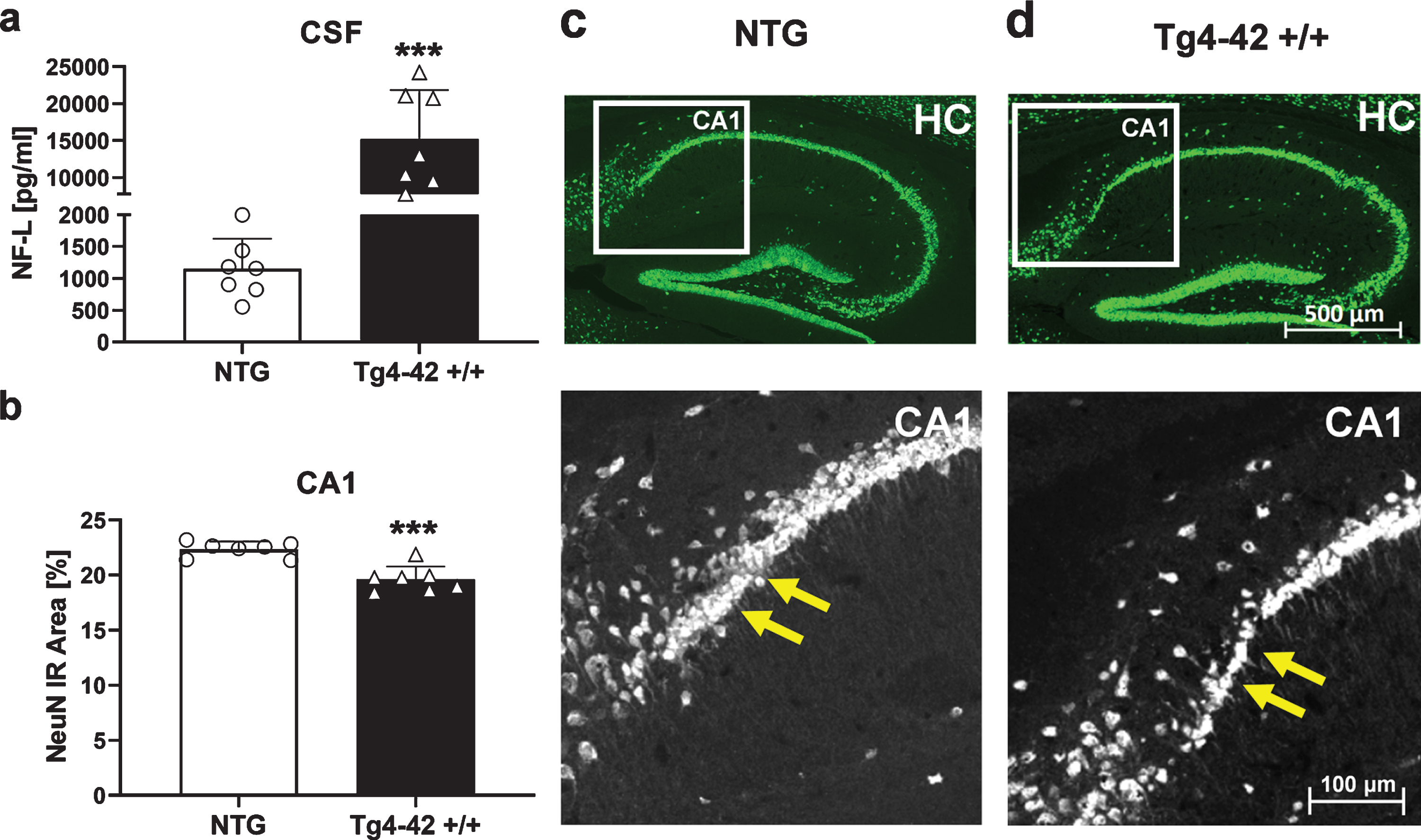 Quantification of neurons in the hippocampus of 9-month-old Tg4-42 +/+ mice. a) Murine neurofilament light chain levels (NF-L) in CSF samples as pg/ml. b) NeuN expression levels labeling neurons in the proximal CA1 region of the hippocampus as immunoreactive (IR) area in percent. a, b) n = 7 per group. Mean + SEM. Unpaired t-test. ***p < 0.001. c, d) Representative images of NeuN labeling in hippocampus samples of 9-month-old Tg4-42 +/+ and non-transgenic mice (NTG). Yellow arrows indicate region of neuronal loss.