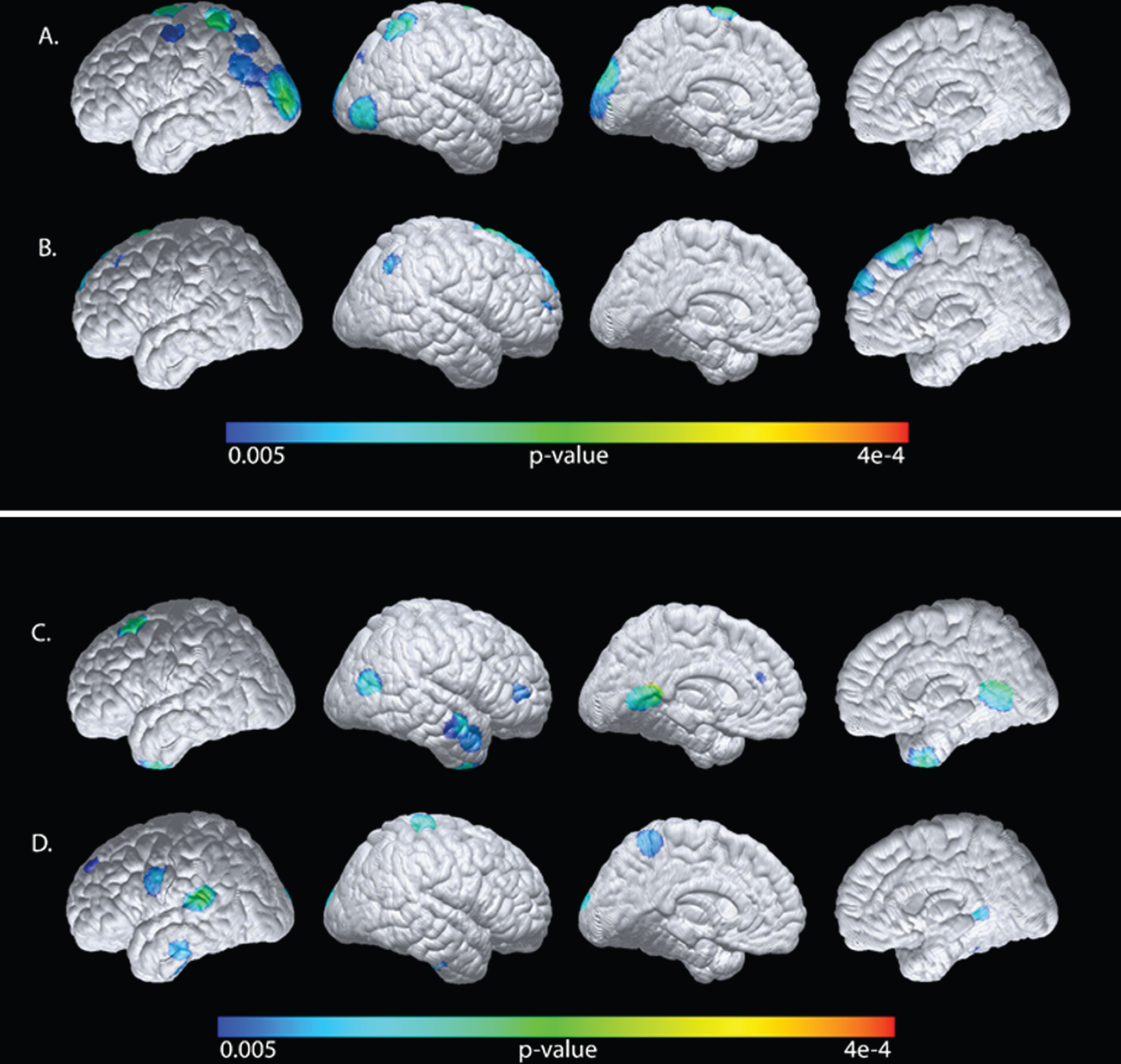 Statistical maps generated from the voxel-wise analyses were superimposed onto a cortical surface map. Negative associations of plasma glucose levels (A), or positive associations of plasma insulin levels (B) with CMRgl after correction for the plasma apoE4/E3 ratio. Negative associations of plasma glucose and GMV (C) or positive associations between plasma insulin (D) with GMV after correction for the plasma apoE4/E3 ratio.