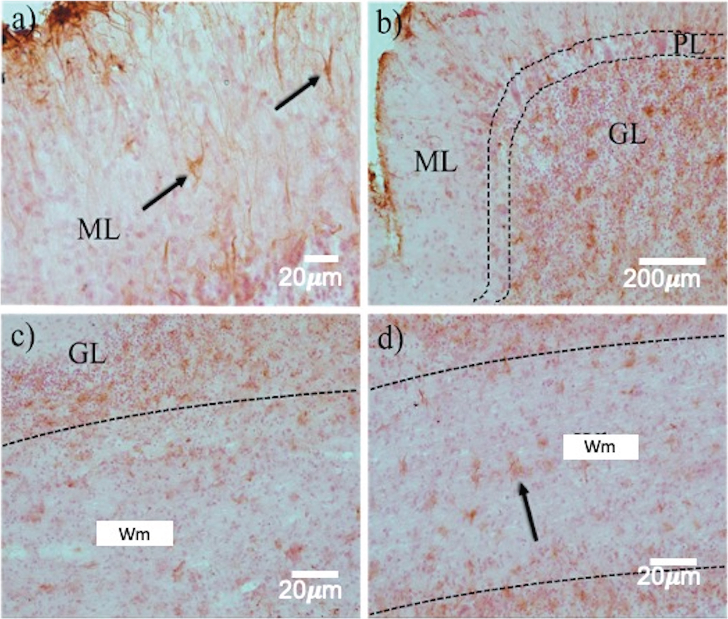 Astrogliosis in the layers of the cerebellum in prion disease. GFAP immunohistochemistry revealed a highly variable expression pattern in the different cell layers. Between ML a) and GL (b, c), a dramatic increase in reactive astrocytes (arrows) was observed. d) In the Wm, astrocytosis is kept in a smaller quantity. ML, Molecular layer; GL, Granular layer; Wm, white matter. White arrows point out Purkinje neurons.