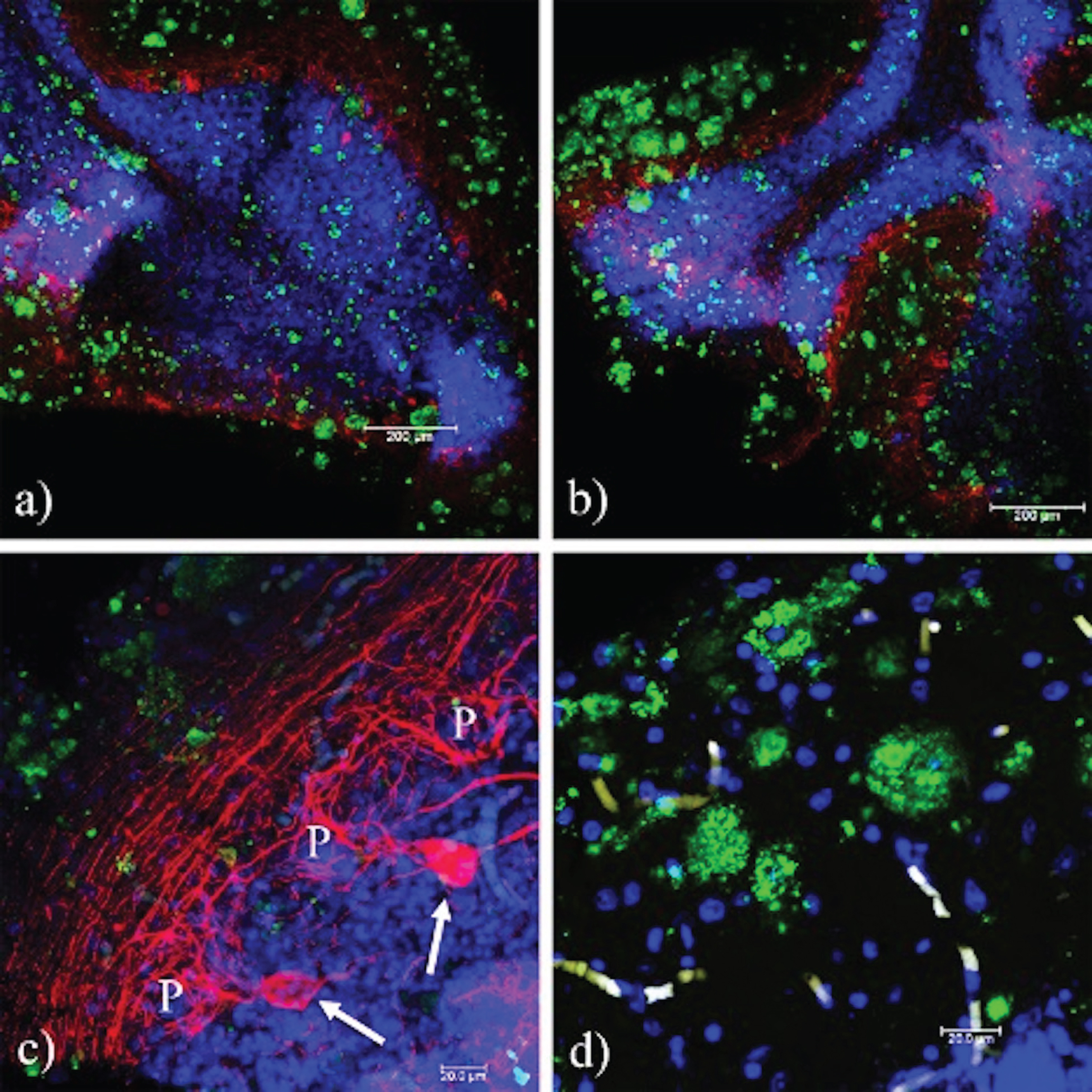 Phosphorylated tau in the cerebellum. In a) and b) pT231 reactivity (red) demonstrates phosphorylation of tau at Thr-231 in both external and internal folia, respectively. Aggregated PrPSc (green) and nuclei (blue) are shown. c) Parallel fibers stained with pT231 in the ML. d) No reactivity is observed with the pT396 antibody. In the magnification of b), axons of the Purkinje cells recognized with the pT231 antibody are indicated. ML, molecular layer; Wm, white matter; P, Purkinje cells. Images obtained with the Leica SP8 confocal microscope.