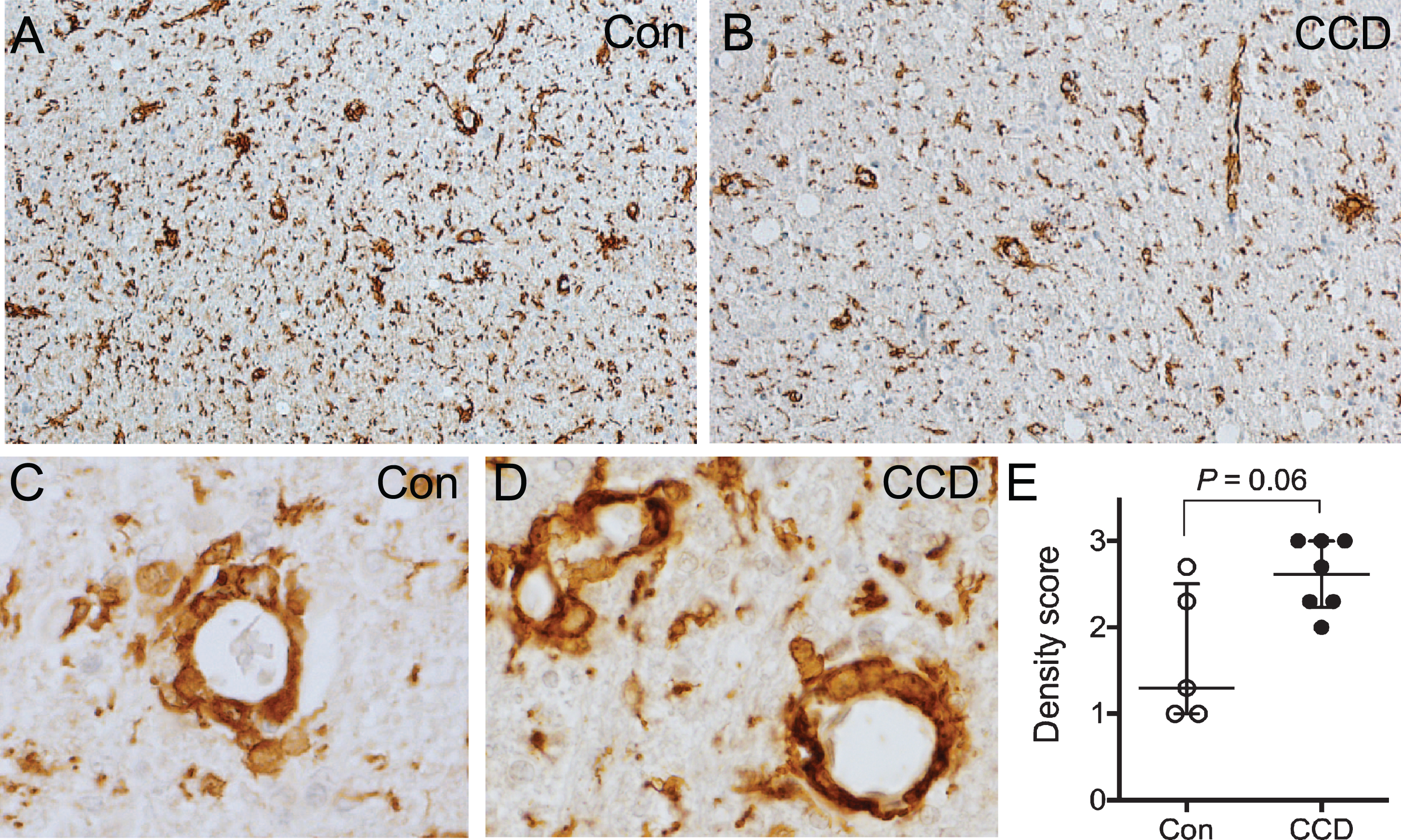 Perivascular macrophage infiltrates in the subcortical white matter. A, B) Overview of the subcortical white matter showing Iba1+ perivascular macrophages in a control dog (A), and a CCD dog (B). C, D) High magnification of vessels surrounded by Iba1+ perivascular macrophages in a control dog (C) and a CCD dog (D) in subcortical white matter. E) Scoring of Iba1+ perivascular macrophages in subcortical white matter revealed a tendency towards a stronger perivascular macrophage infiltration in CCD dogs (Mann Whitney, p = 0.06). Con, n = 5; CCD, n = 7.
