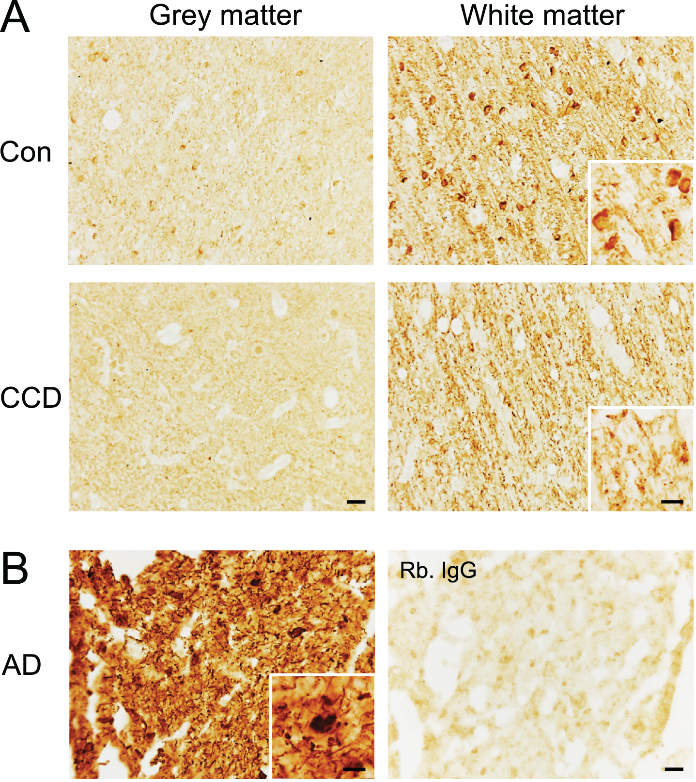 Phosphorylation of the S396 phospho-epitope of tau in white matter in the frontal cortex of CCD and control dogs. Sections of frontal cortex from CCD and control dogs (A) and AD patients (B) stained for S396. A) Phosphorylation of S396 tau was observed as a fiber-staining in the subcortical white matter, while a fainter signal was observed in the grey matter. A dense signal also observed was oligodendrocyte-like cells (inserts) in some dogs. Rabbit IgG controls shown in Supplementary Figure 4 were blank. B) Hyperphosphorylated S396 tau in AD grey matter showing typical neuropil threads and NFTs (insert). Rabbit IgG is almost blank. AD, Alzheimer’s disease; CCD, Canine cognitive dysfunction; Con, control. Scale bars: 20μm (inserts: 10μm).