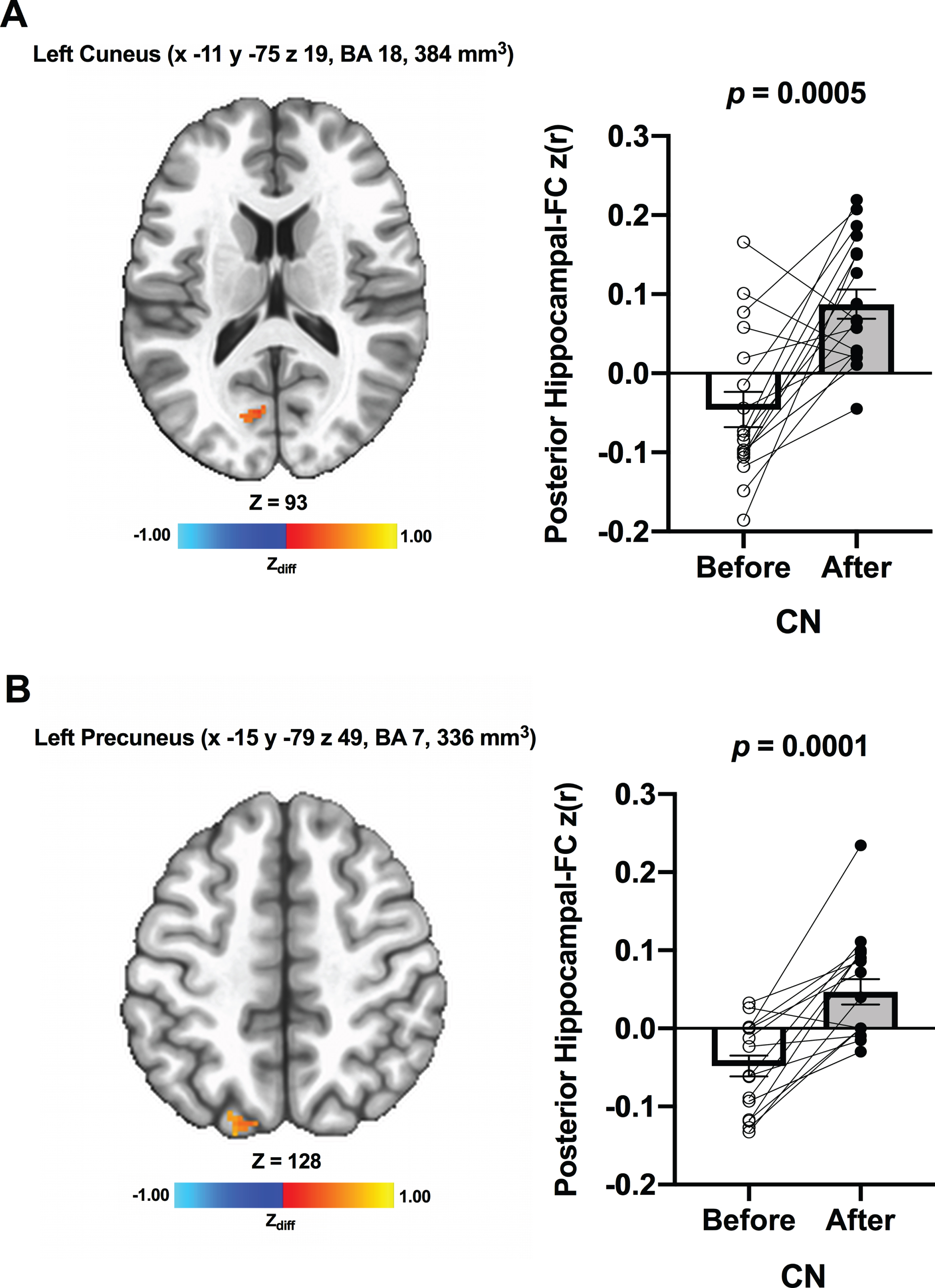 Increased functional connectivity between posterior hippocampal seed and (A) left cuneus and (B) left precuneus, respectively, were found from before to after ET in CN individuals. Adjacent bar graphs indicate the connectivity between each hippocampal seed and right posterior cingulate (±SEM) for before and after ET. p-values above bar graphs indicate statistical difference from before to after ET.