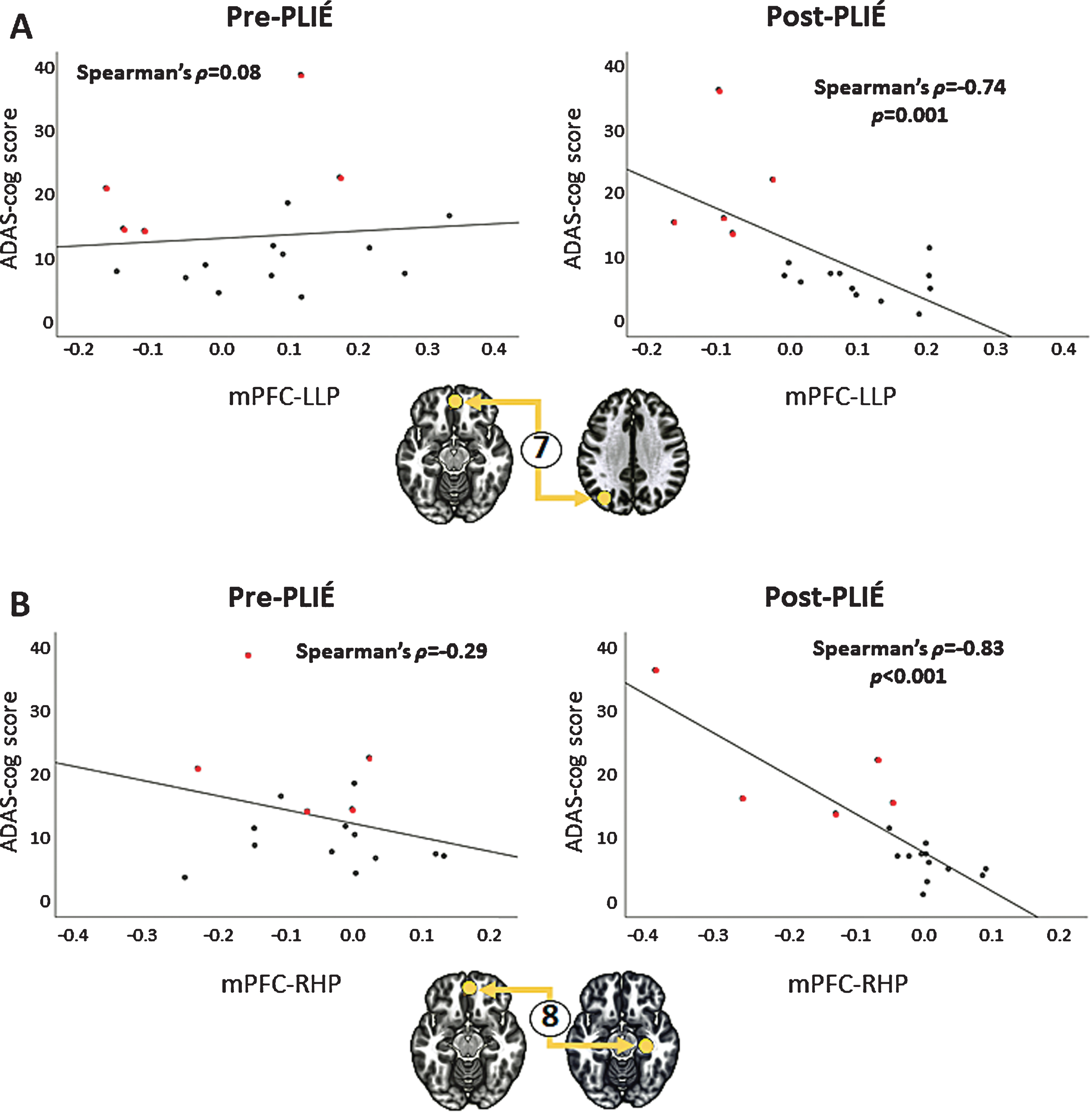 Relationship between ADAS-cog scores and the strength of connection between the medial prefrontal cortex (mPFC) and (A) left lateral parietal cortex (LLP), connection #7 in Fig. 3, and (B) the right hippocampus (RHL), connection #8 in Fig. 3, after PLIÉ. Prior to PLIÉ, there were no significant correlations between ADAS-cog scores and the strength of these connections. Red circles represent participants with MCI.