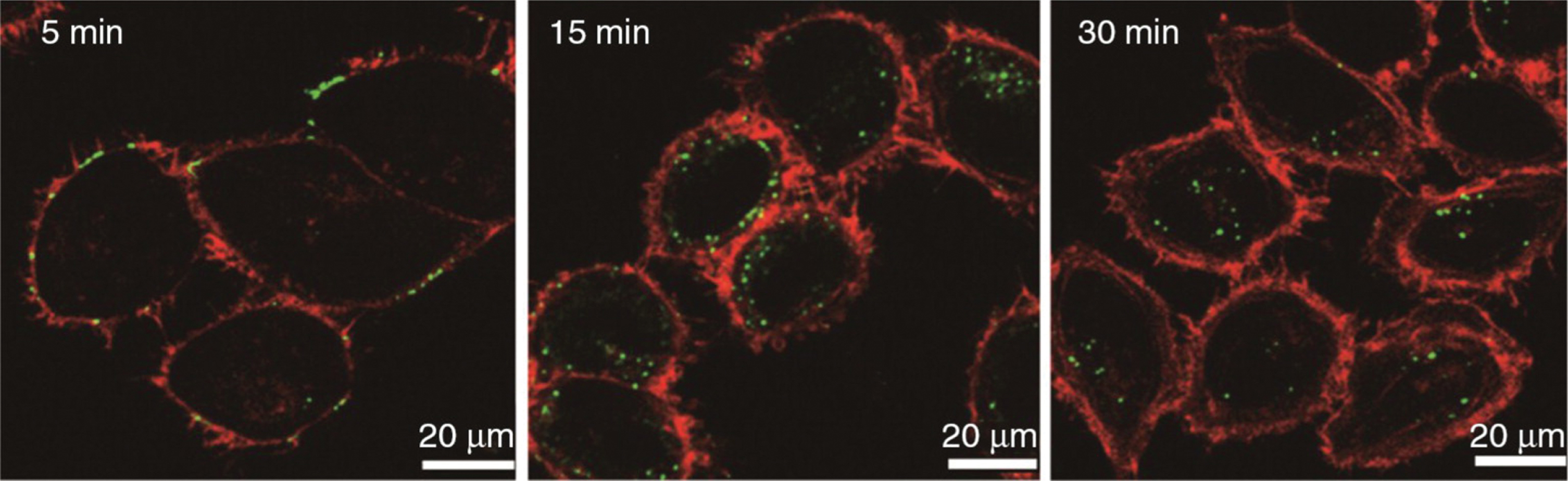 Time course study using labeled P. gingivalis OMVs (lime green circles) in human HOK epithelial cells. All OMVs were found within cells by 30 minutes. Reprinted from Olsen I, Amano A (2015) Outer membrane vesicles – offensive weapons or good Samaritans? J Oral Microbiol 7, 1, with permission by Taylor & Francis Ltd (http://www.tandfonline.com).