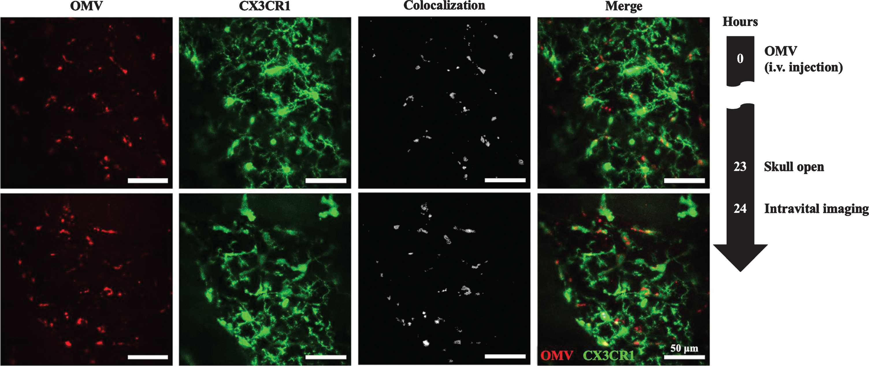 Delivery of Aa OMVs into microglial cells. Intravital image was captured 24 h after Aa OMV i.v. injection. OMVs were colocalized with GFP-positive microglial cells. Scale bar: 50μm. Reprinted with permission from Ha JY, Choi SY, Lee JH, Hong SH, Lee HJ (2020) Delivery of periodontopathogenic extracellular vesicles to brain monocytes and microglial IL-6 promotion by RNA Cargo. Front Mol Biosci 7, 596366, under the Creative Commons Attribution License (CC BY).