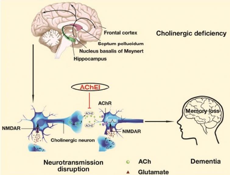Simplified drawing of the Cholinergic Hypothesis. Reprinted from Wang Y, Wang H, Chen HZ (2016) AChE inhibition-based multi-target-directed ligands, a novel pharmacological approach for the symptomatic and disease-modifying therapy of Alzheimer’s disease. Curr Neuropharmacol 14, 364–375, under the Creative Commons Attribution-Non-Commercial 4.0 International Public License (CC BY-NC 4.0).